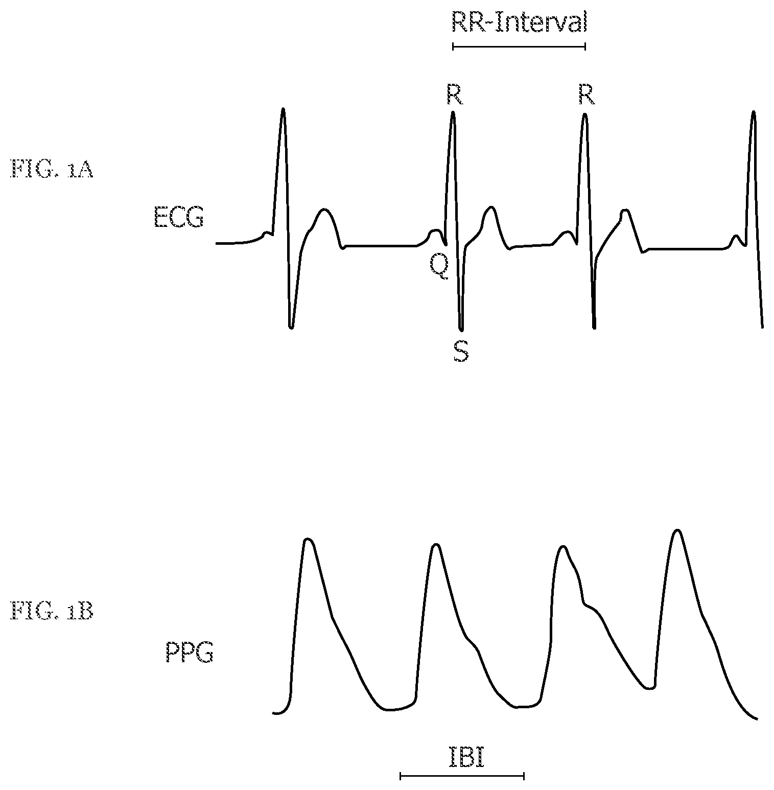 Patent US11793406 Figure 1 – Image processing method and corresponding system