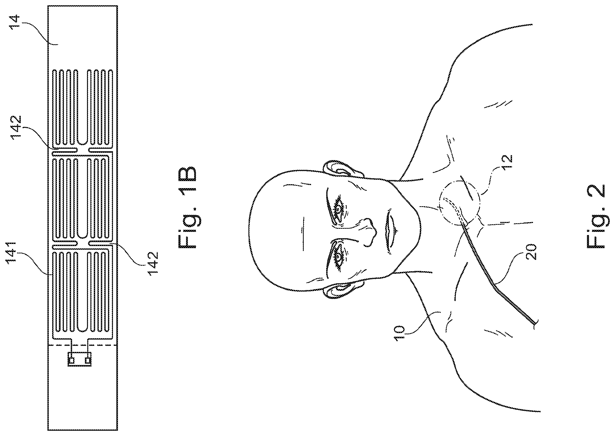Patent US11793409 Figure 2 – System for the early detection of postoperative bleeding