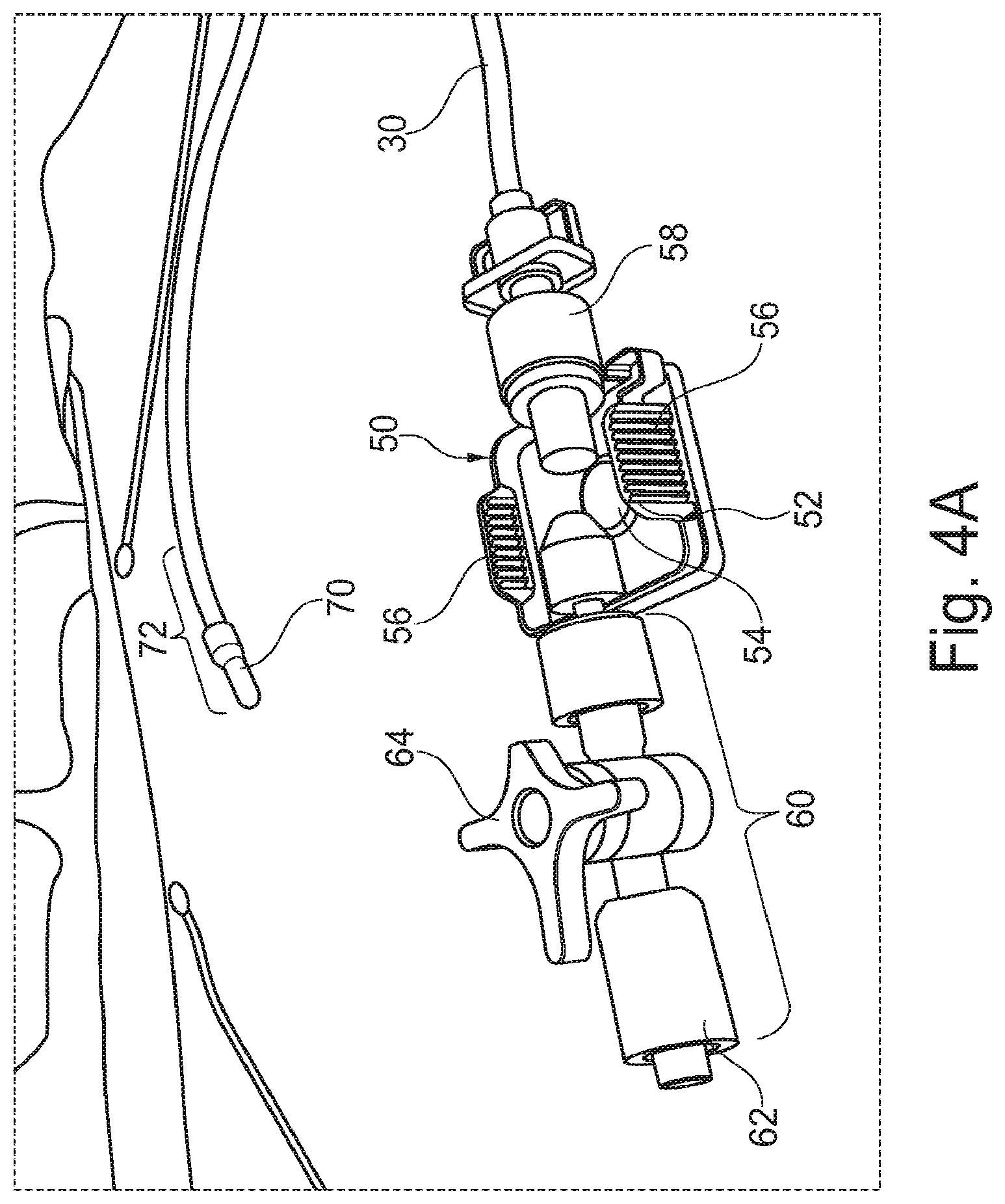 Patent US11793409 Figure 5 – System for the early detection of postoperative bleeding