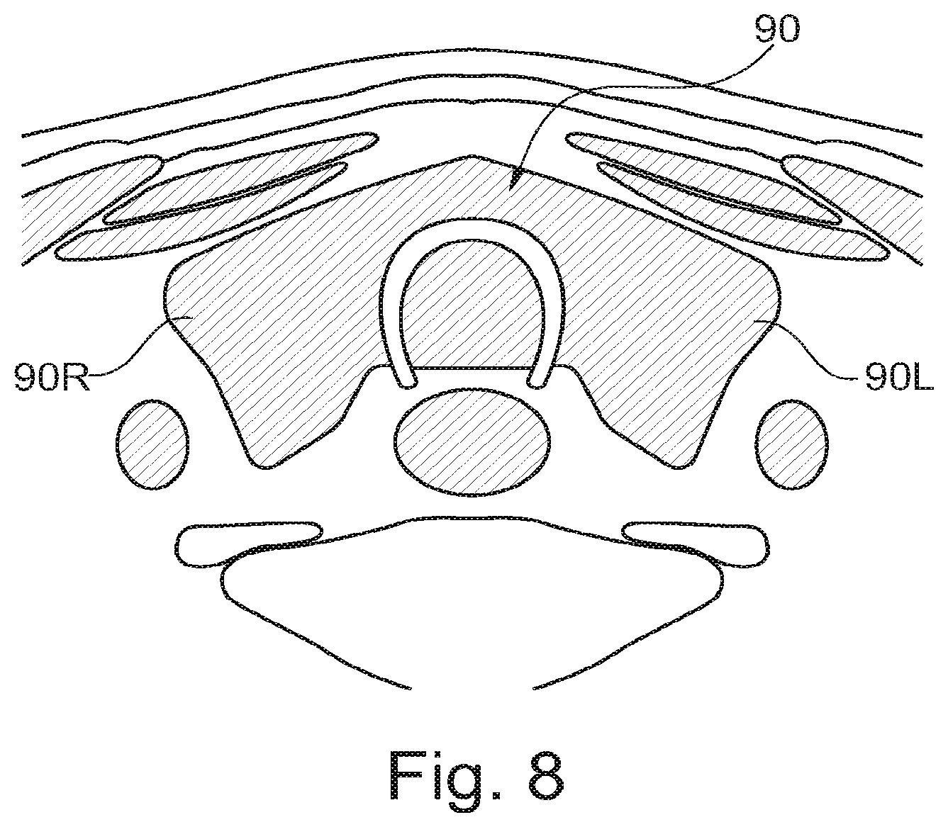 Patent US11793409 Figure 9 – System for the early detection of postoperative bleeding