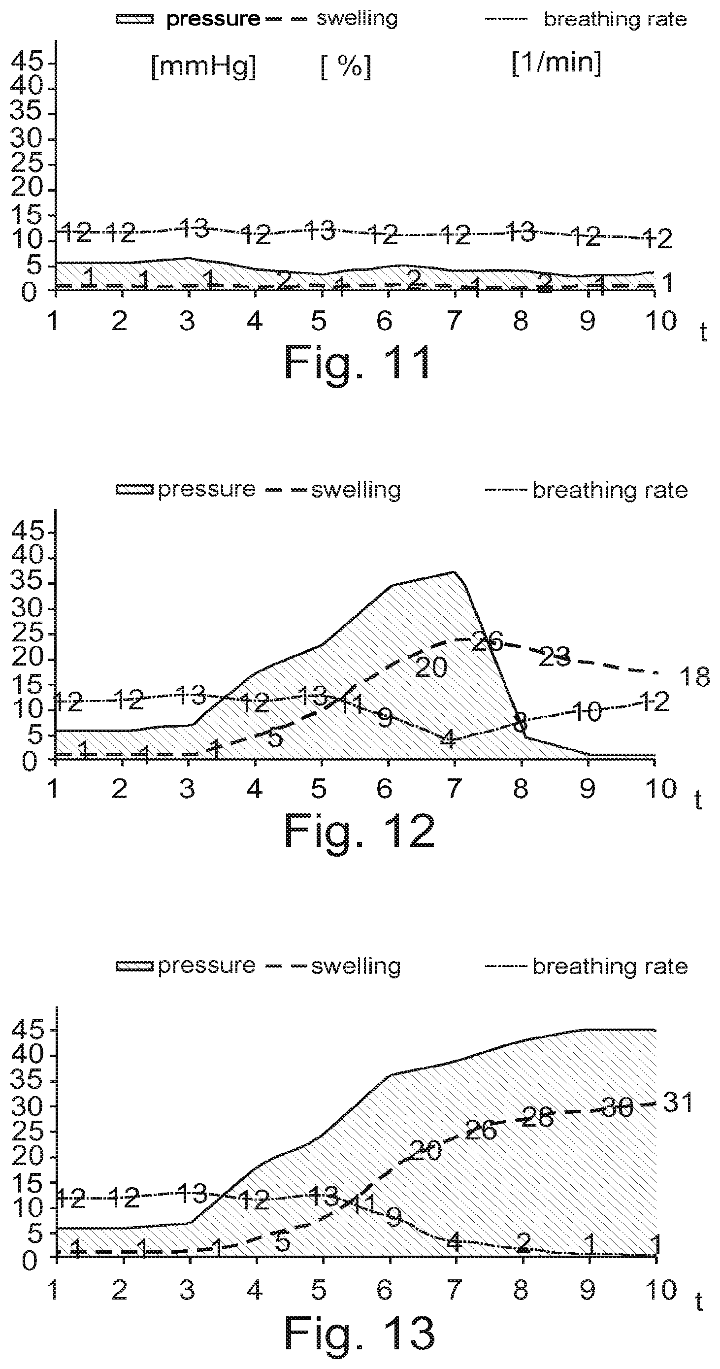 Patent US11793409 Figure 11 – System for the early detection of postoperative bleeding