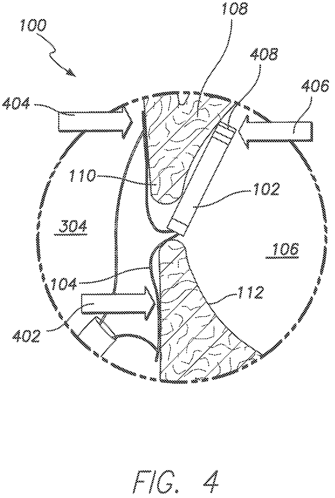 Patent US11793413 Figure 4 – Wireless MEMS left atrial pressure sensor