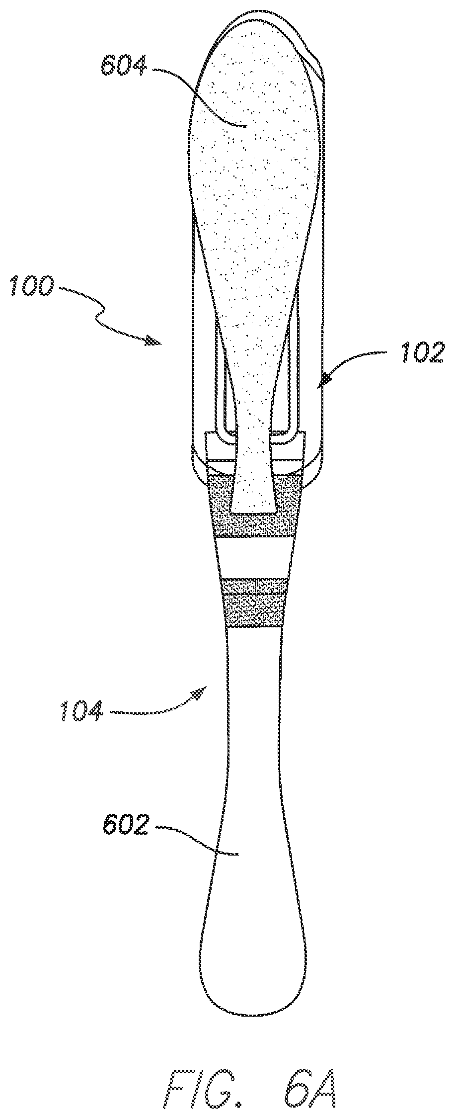 Patent US11793413 Figure 6 – Wireless MEMS left atrial pressure sensor