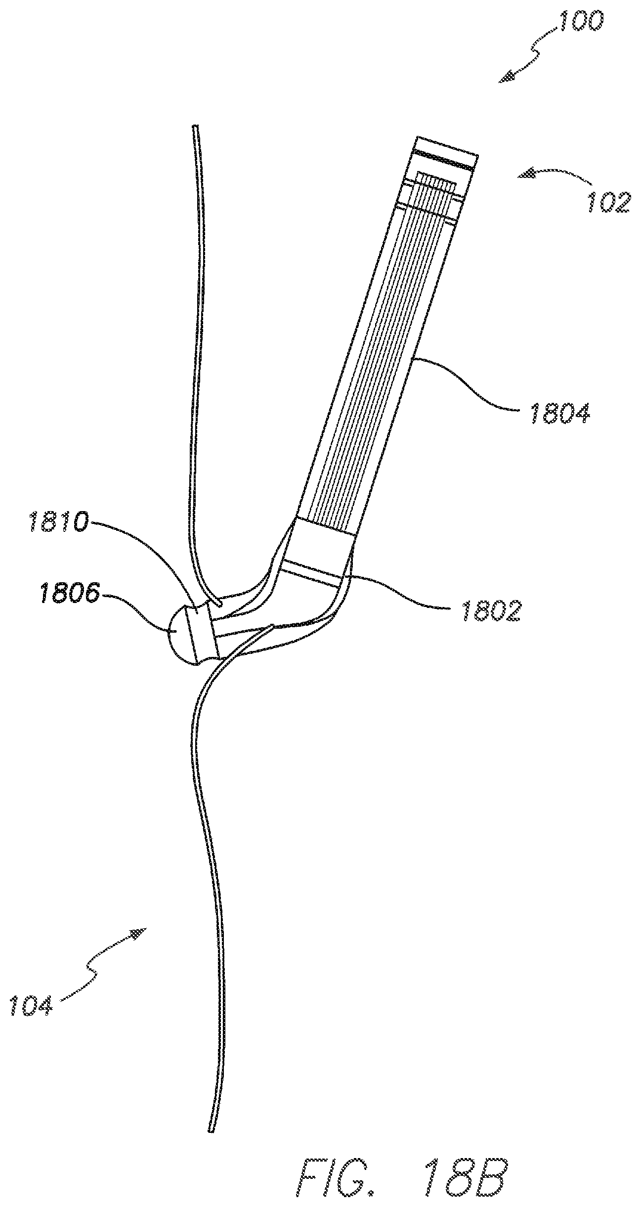 Patent US11793413 Figure 19 – Wireless MEMS left atrial pressure sensor