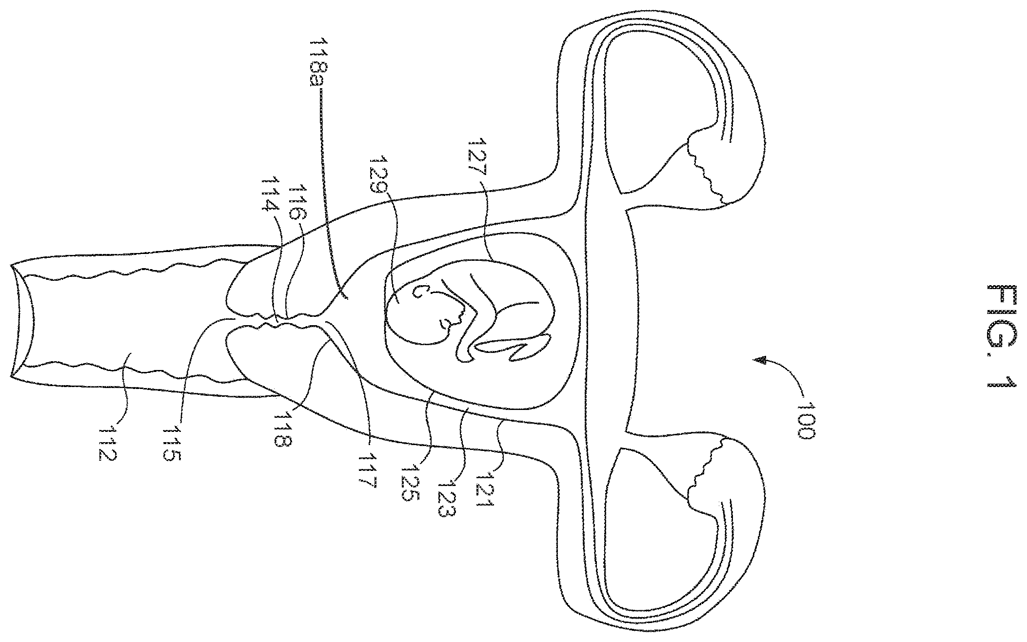 Patent US11793416 — System and method for child-bearing monitoring and assistance — Figure 1