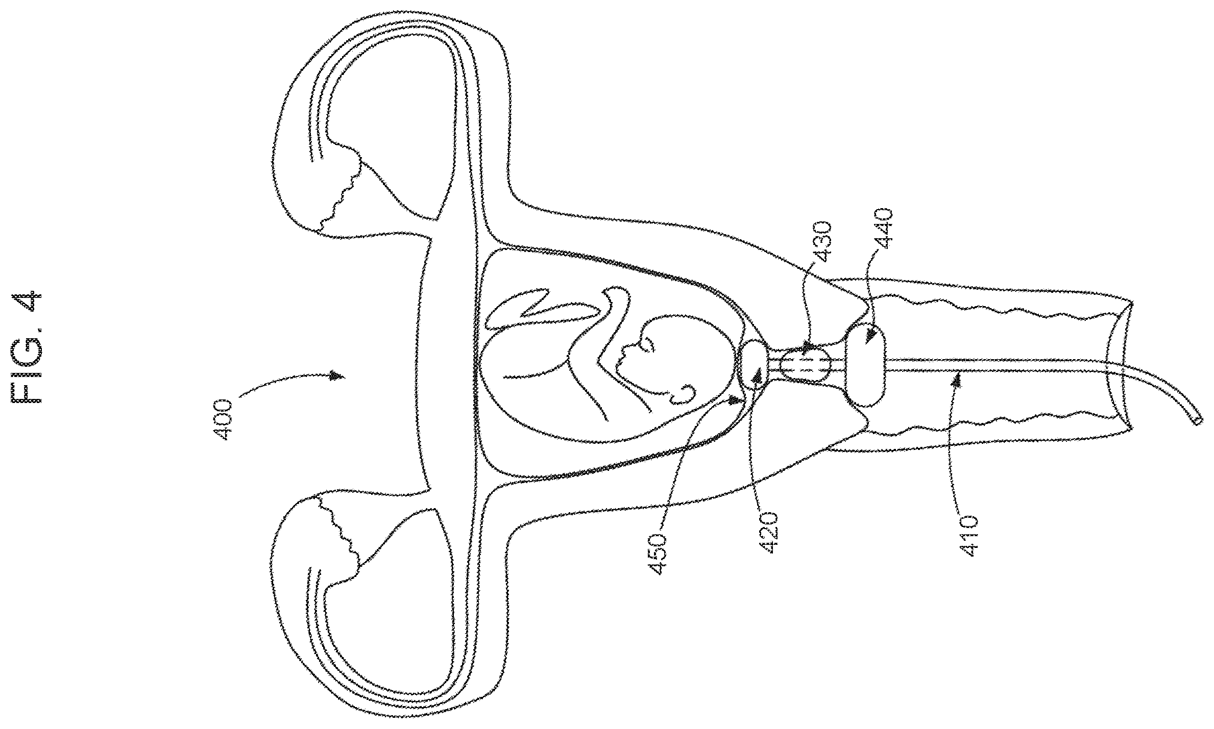 Patent US11793416 Figure 4 – System and method for child-bearing monitoring and assistance