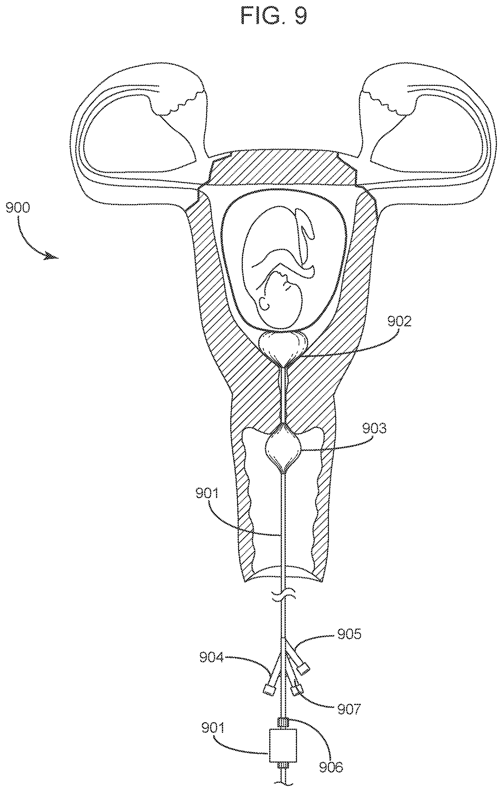 Patent US11793416 Figure 12 – System and method for child-bearing monitoring and assistance
