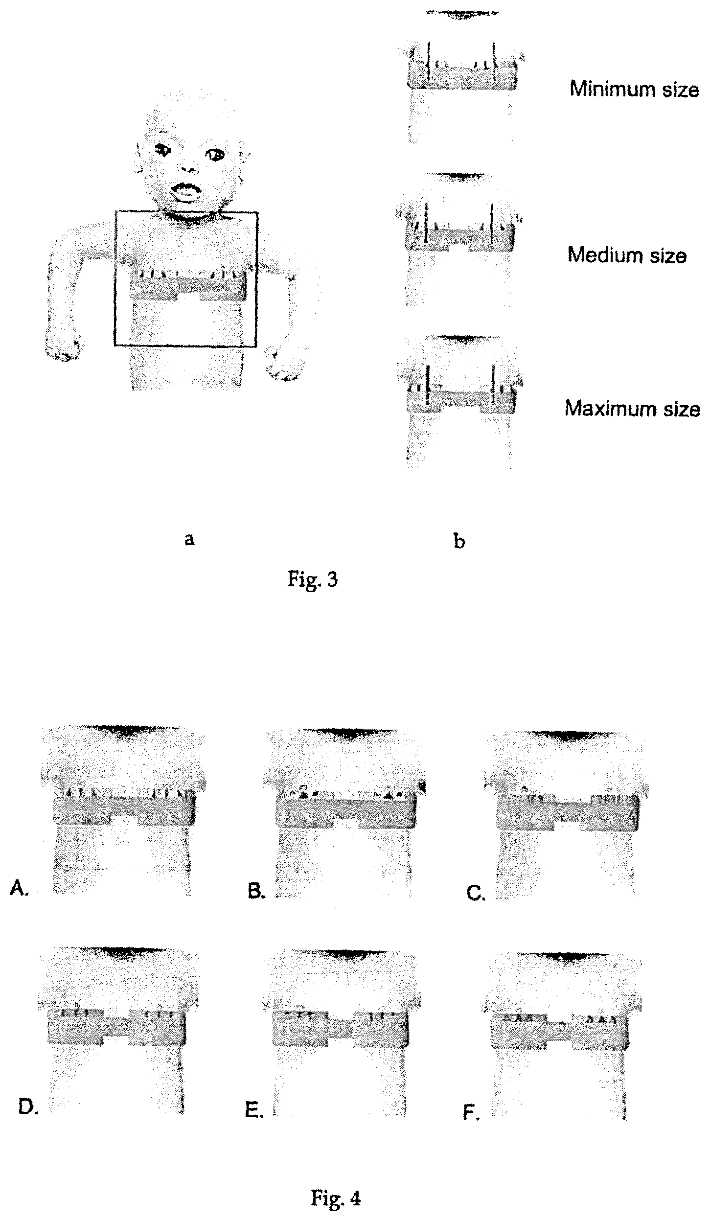 Patent US11793418 Figure 2 – Sensor belt and positioning aid for electro-impedance tomography imaging in neonates