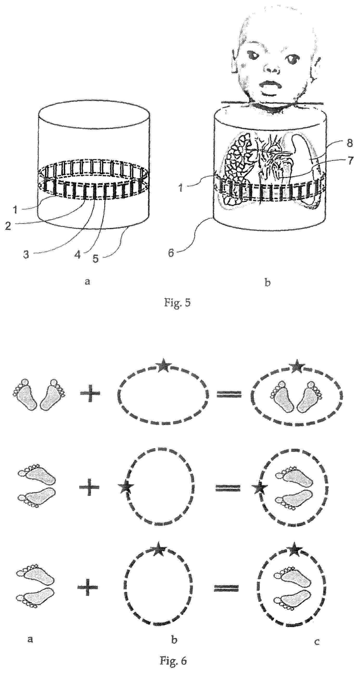 Patent US11793418 Figure 3 – Sensor belt and positioning aid for electro-impedance tomography imaging in neonates