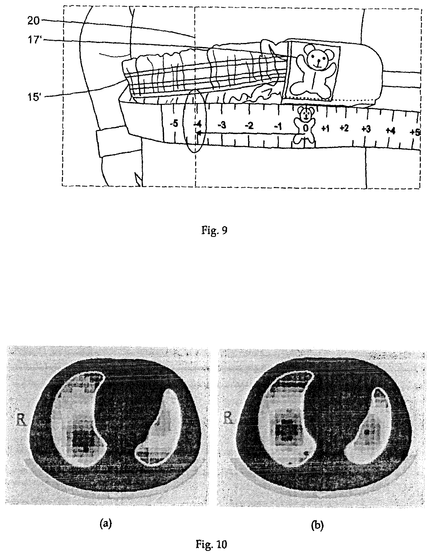 Patent US11793418 Figure 6 – Sensor belt and positioning aid for electro-impedance tomography imaging in neonates