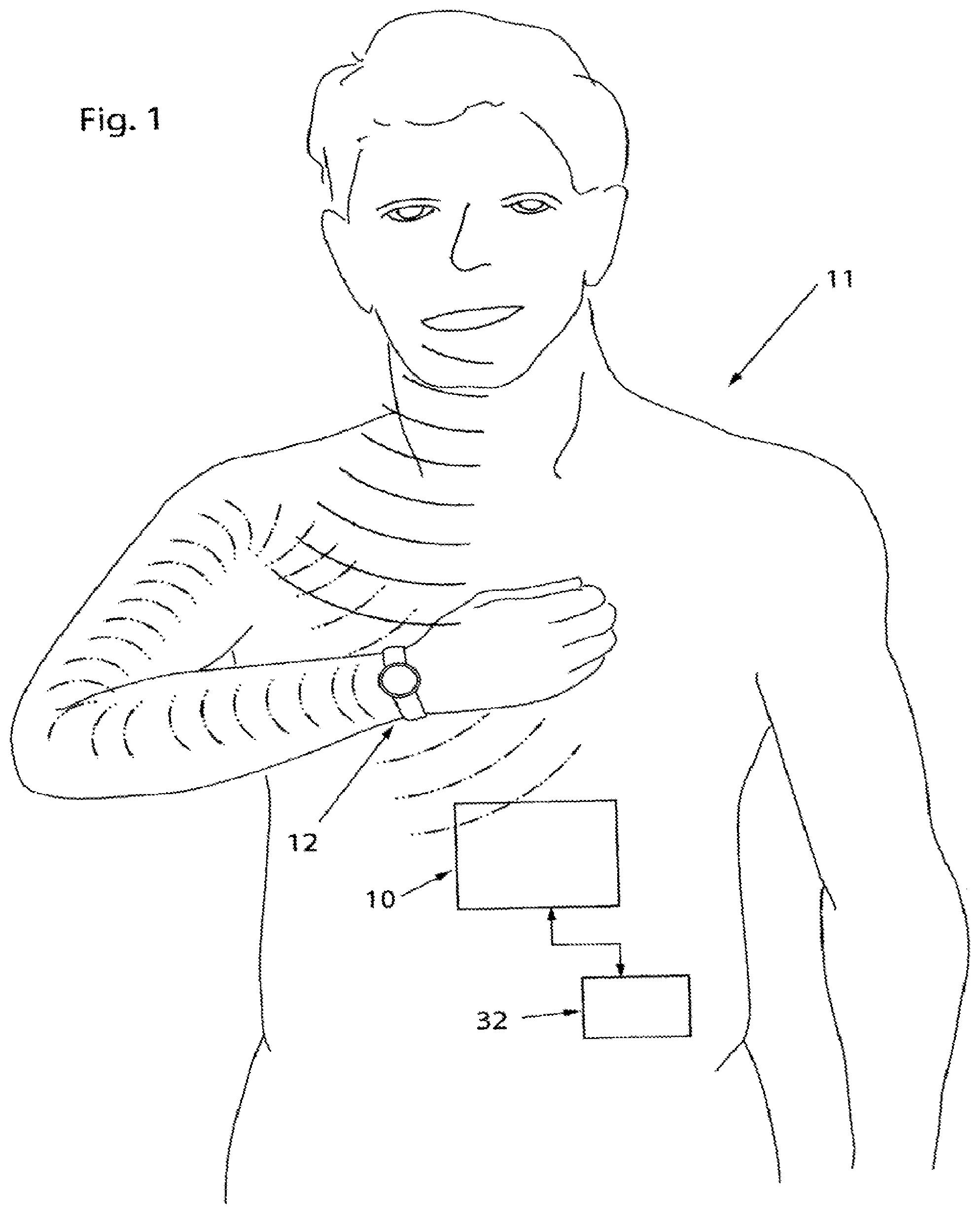 Patent US11793421 Figure 1 – Voice control system for an implant
