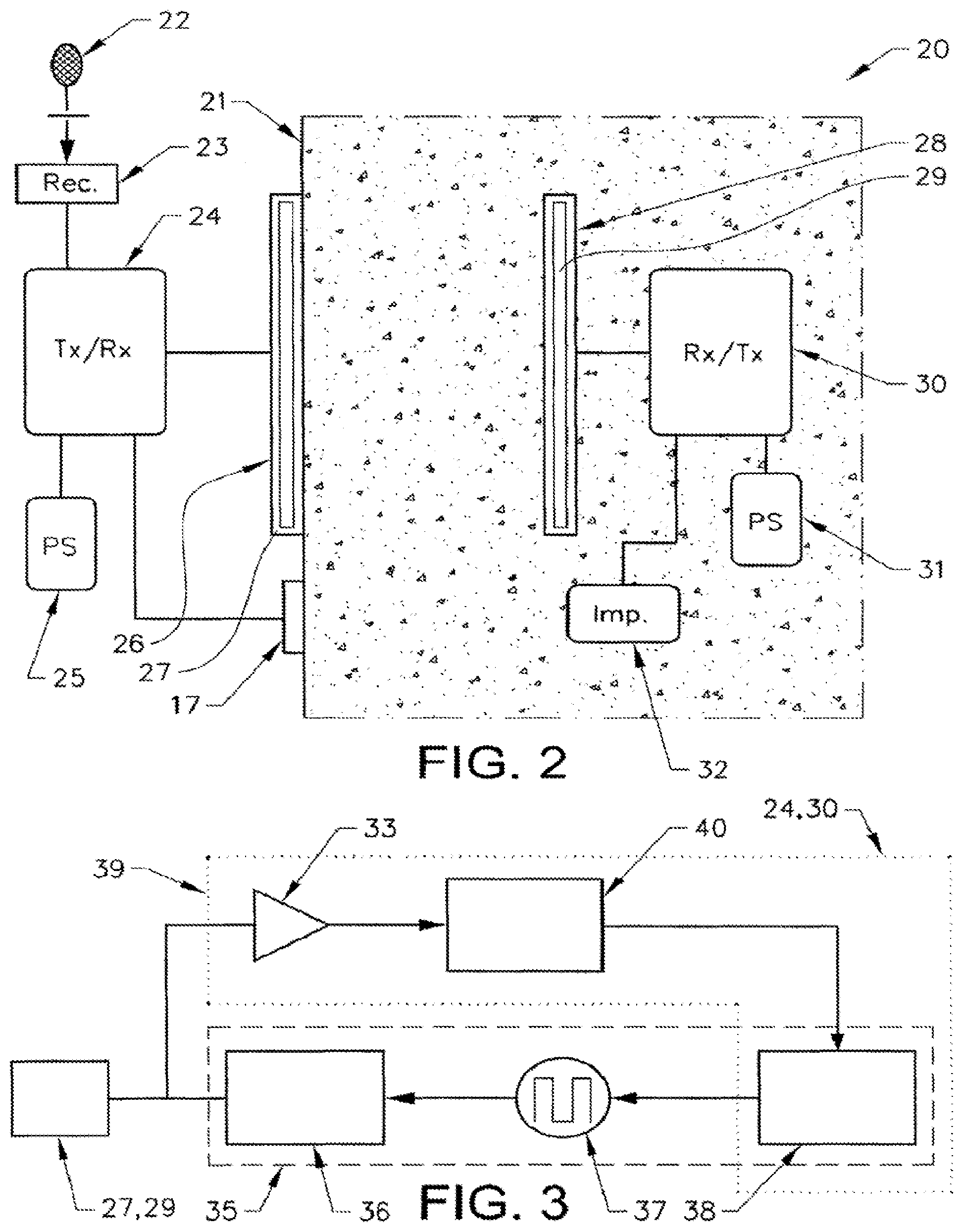Patent US11793421 Figure 2 – Voice control system for an implant