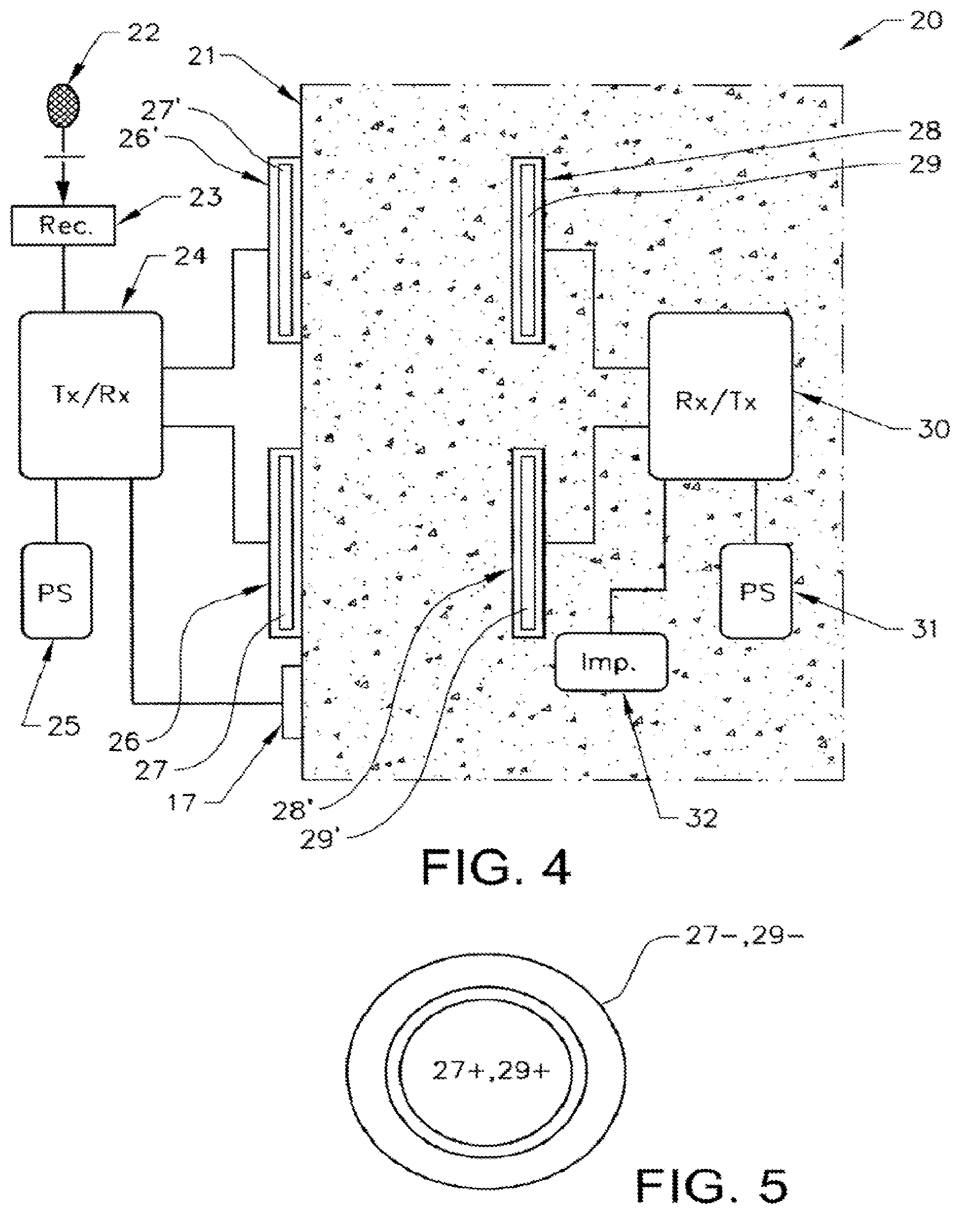Patent US11793421 Figure 3 – Voice control system for an implant
