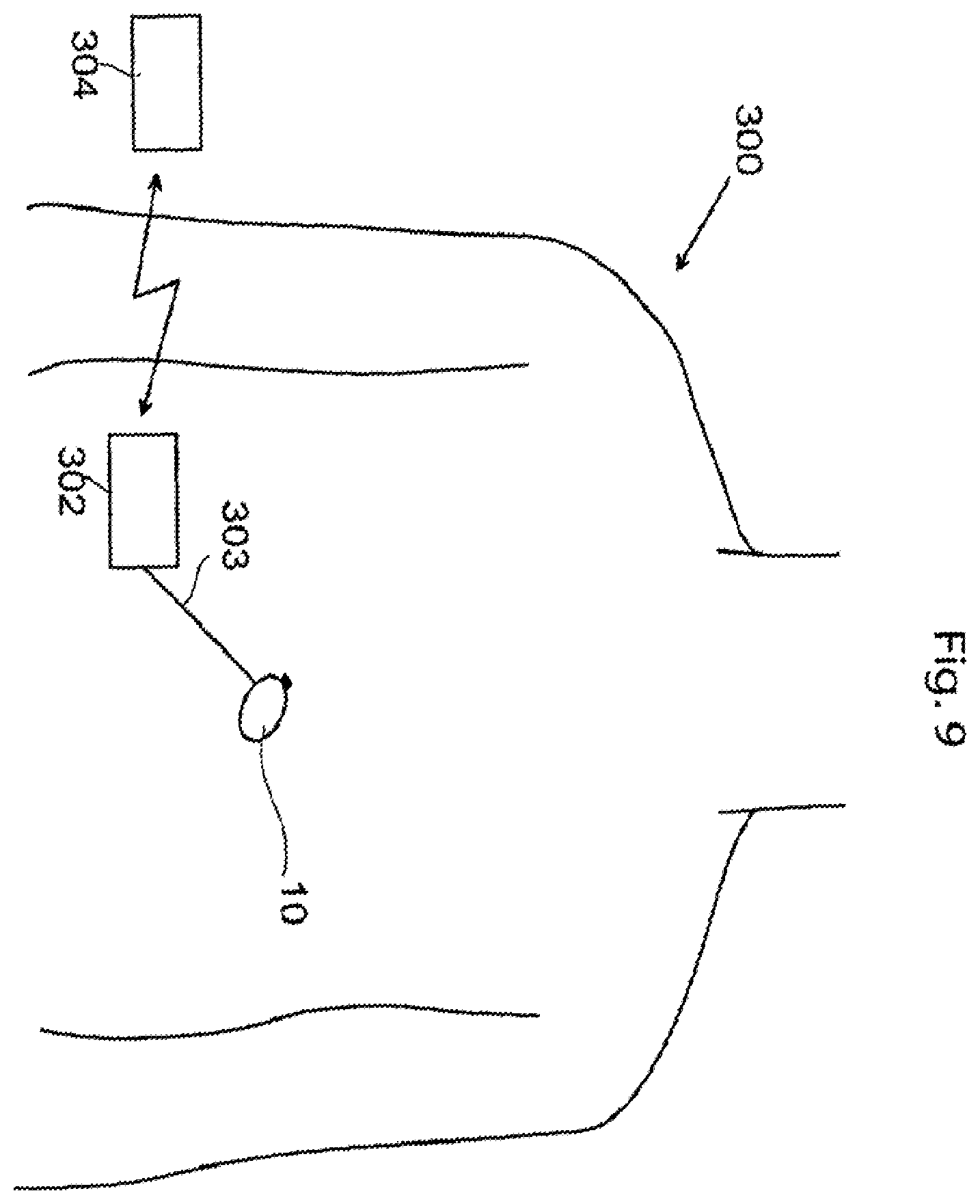 Patent US11793421 Figure 9 – Voice control system for an implant