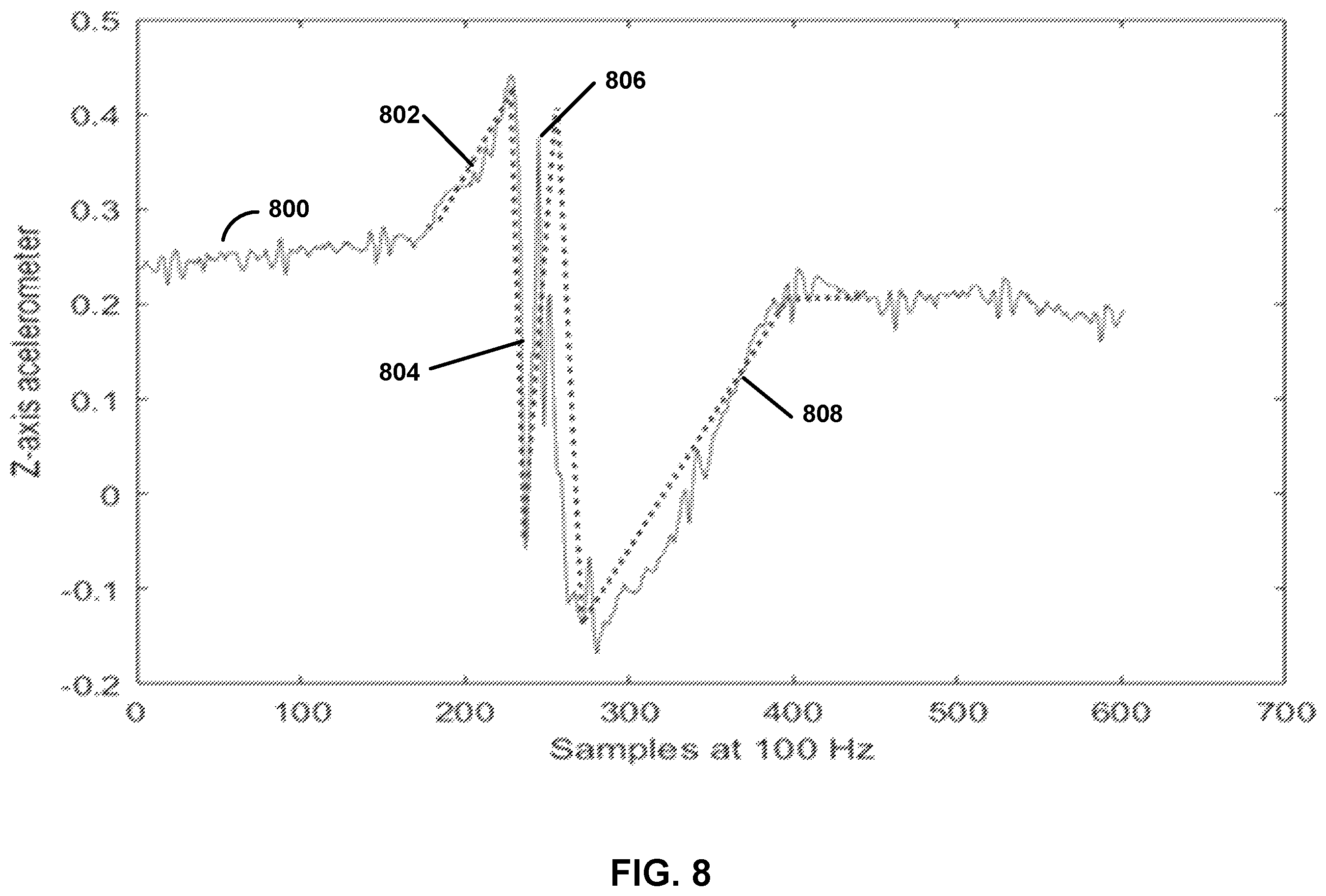 Patent US11793423 Figure 9 – Cough detection using frontal accelerometer