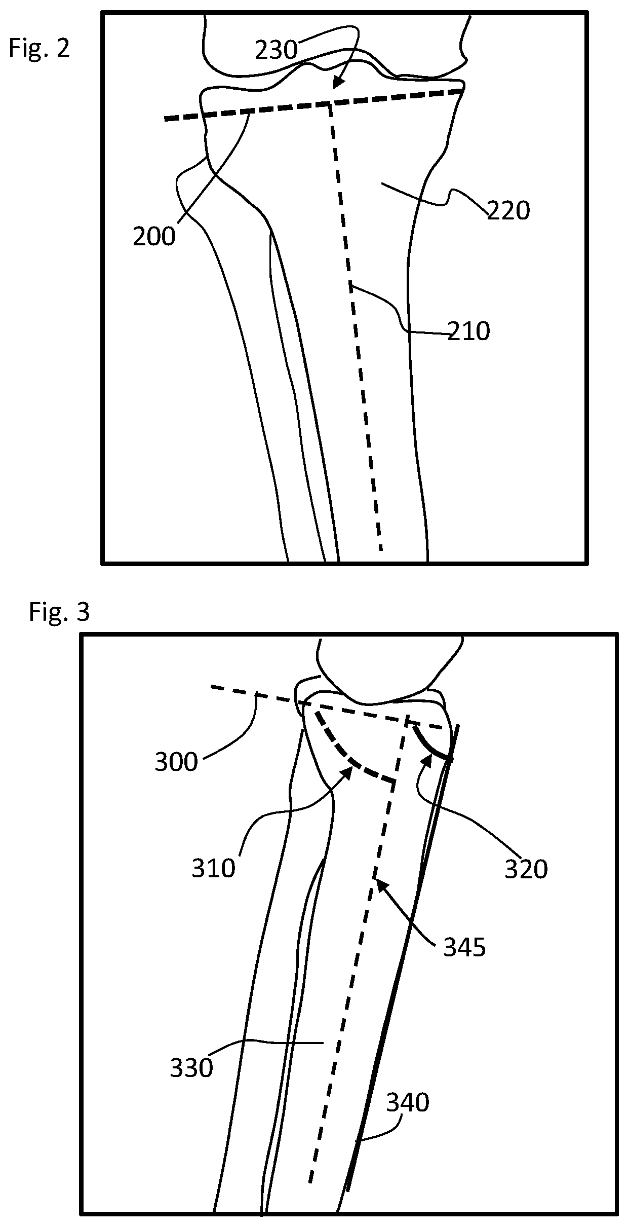 Patent US11793424 Figure 3 – Kinetic assessment and alignment of the muscular-skeletal system and method therefor