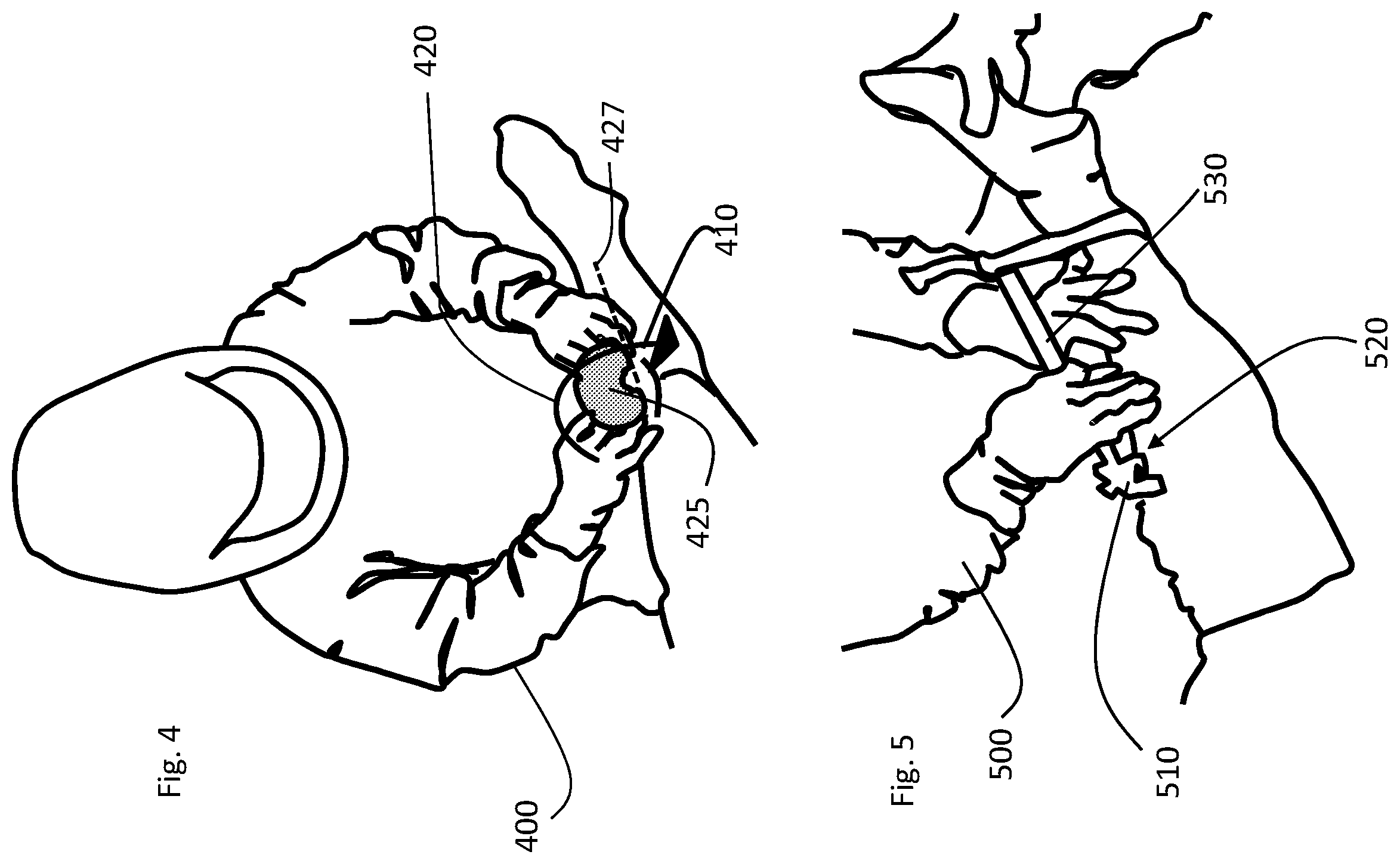 Patent US11793424 Figure 4 – Kinetic assessment and alignment of the muscular-skeletal system and method therefor
