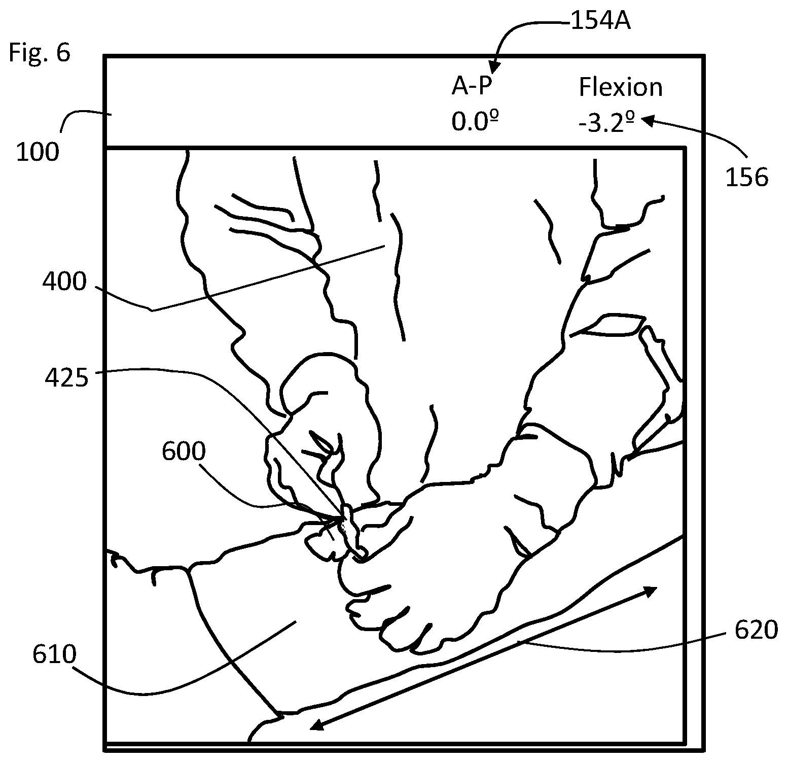 Patent US11793424 Figure 5 – Kinetic assessment and alignment of the muscular-skeletal system and method therefor