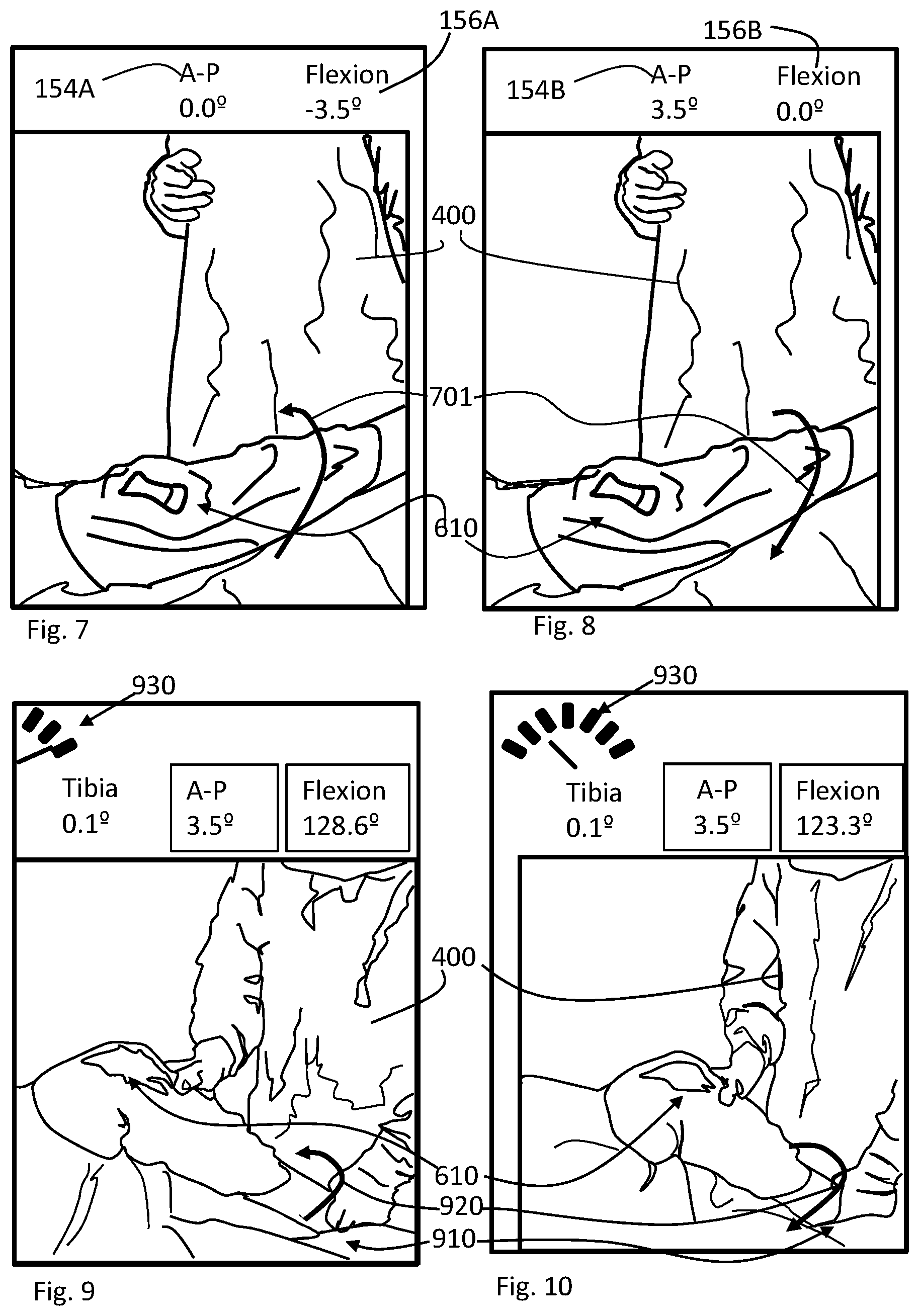 Patent US11793424 Figure 6 – Kinetic assessment and alignment of the muscular-skeletal system and method therefor