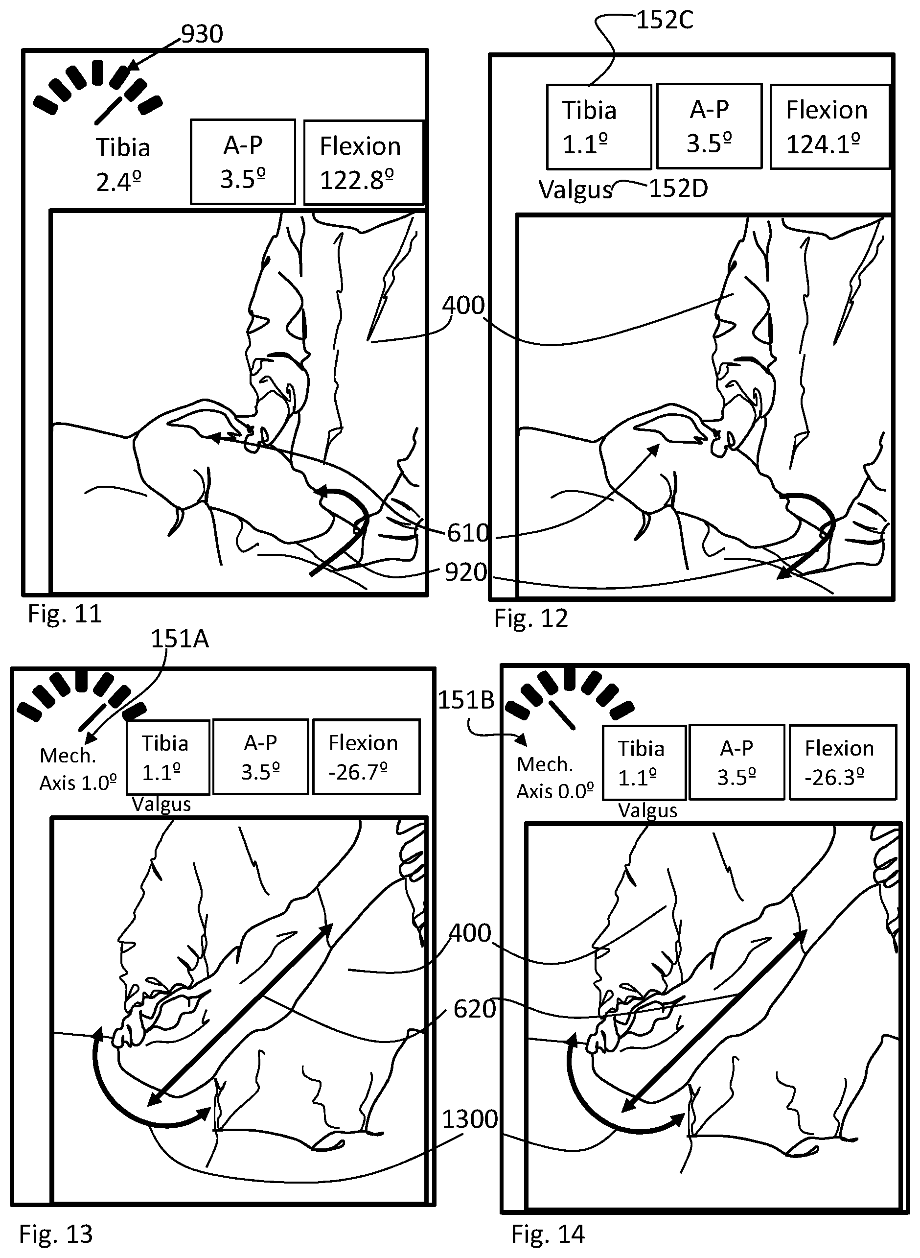 Patent US11793424 Figure 7 – Kinetic assessment and alignment of the muscular-skeletal system and method therefor