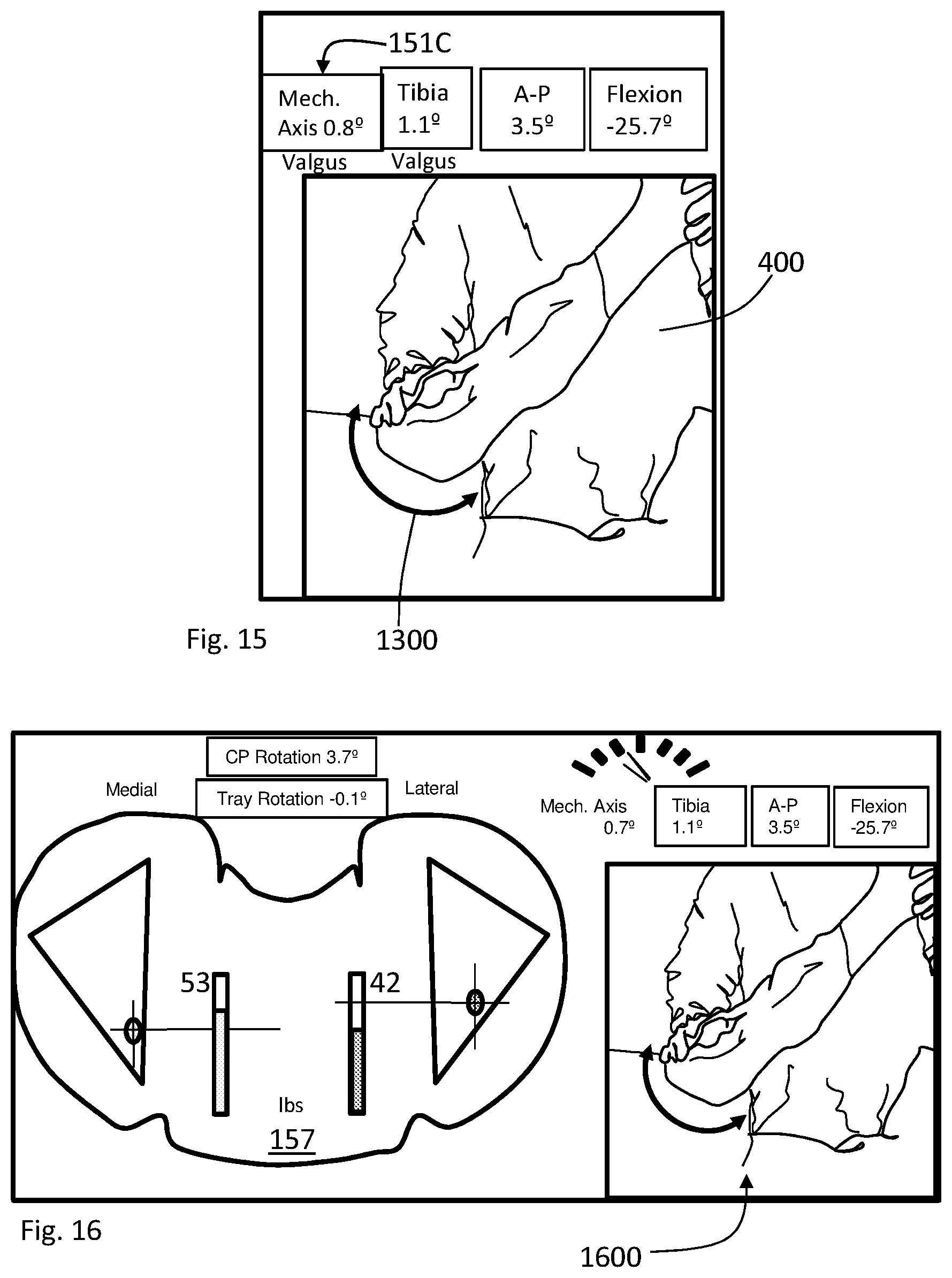 Patent US11793424 Figure 8 – Kinetic assessment and alignment of the muscular-skeletal system and method therefor