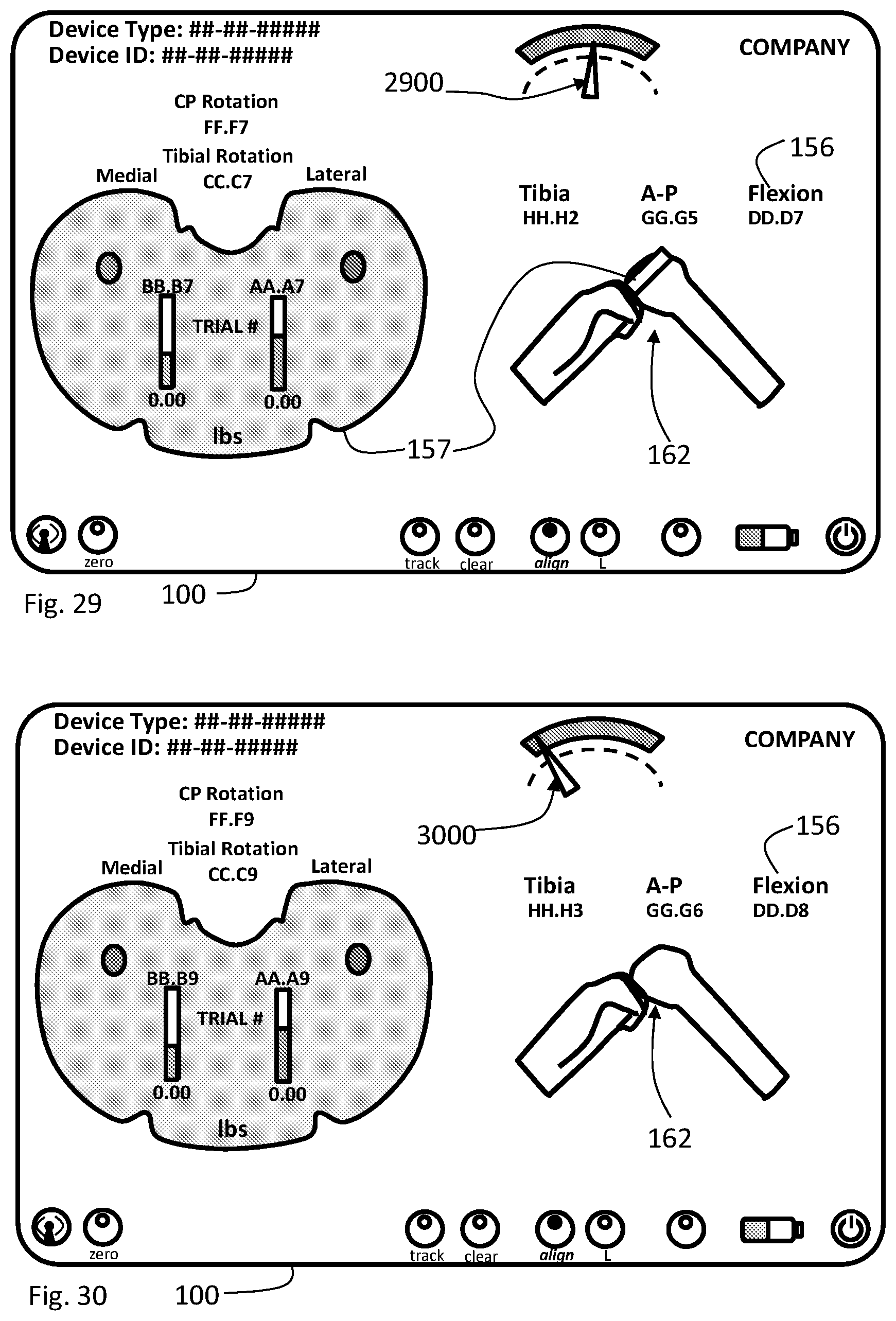 Patent US11793424 Figure 15 – Kinetic assessment and alignment of the muscular-skeletal system and method therefor