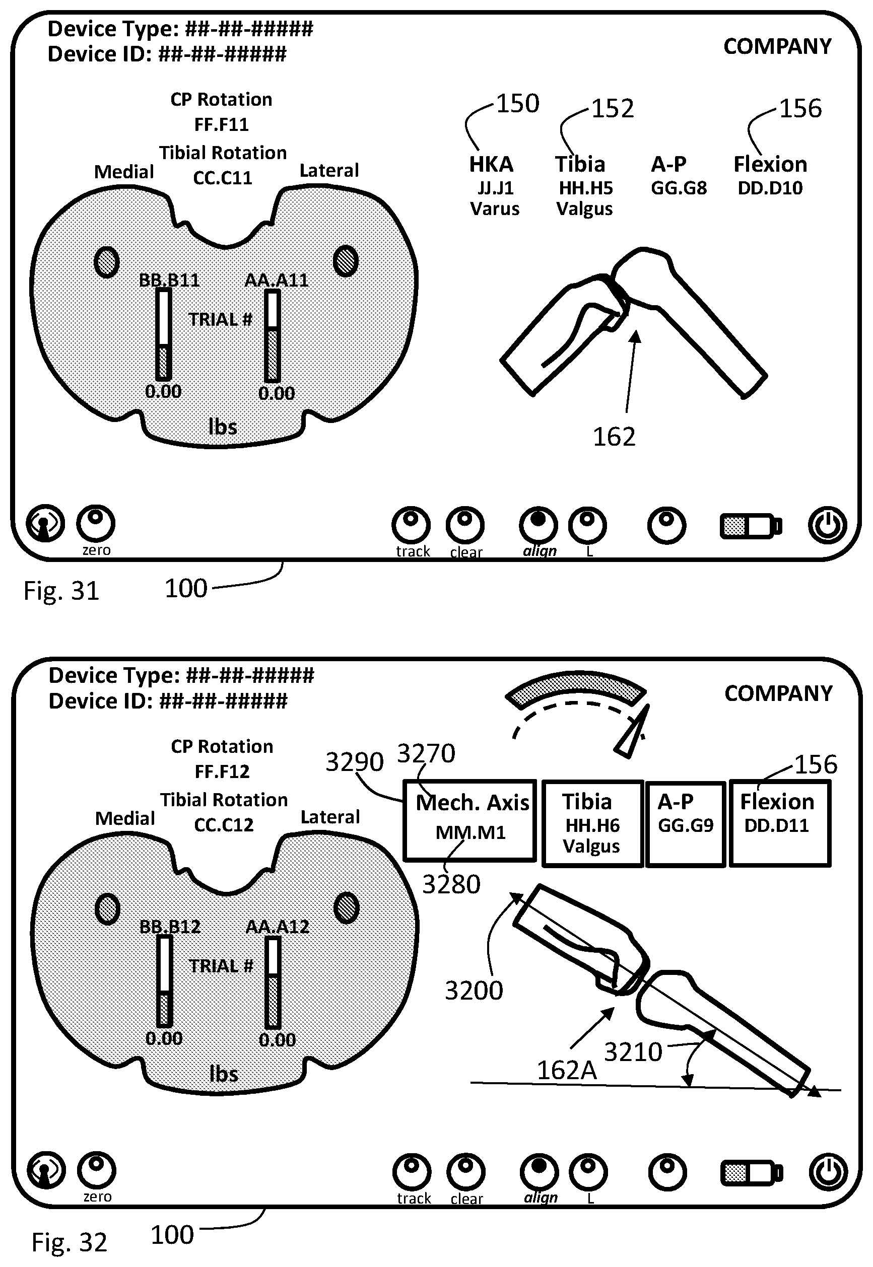 Patent US11793424 Figure 16 – Kinetic assessment and alignment of the muscular-skeletal system and method therefor