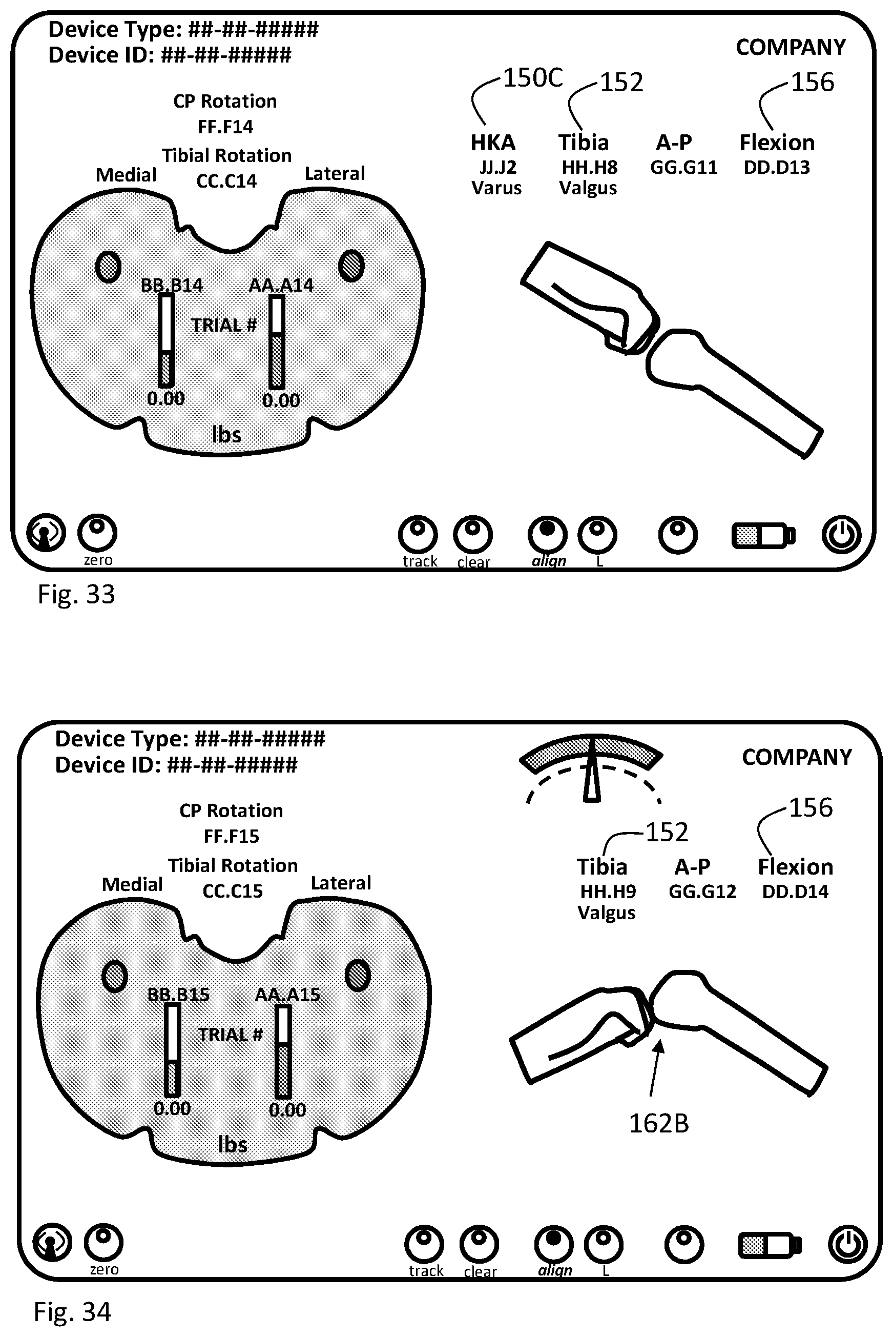Patent US11793424 Figure 17 – Kinetic assessment and alignment of the muscular-skeletal system and method therefor