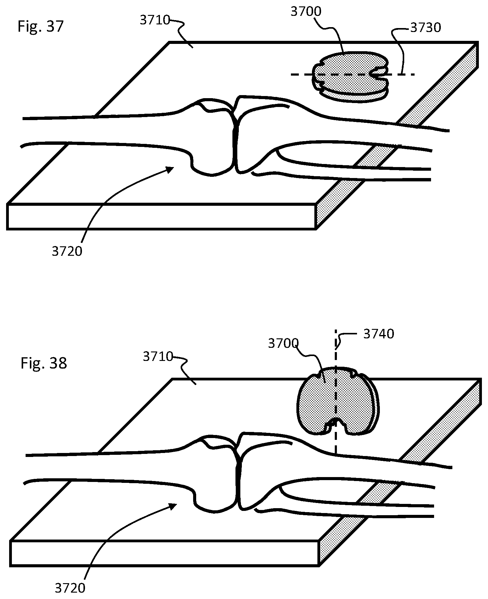 Patent US11793424 Figure 19 – Kinetic assessment and alignment of the muscular-skeletal system and method therefor