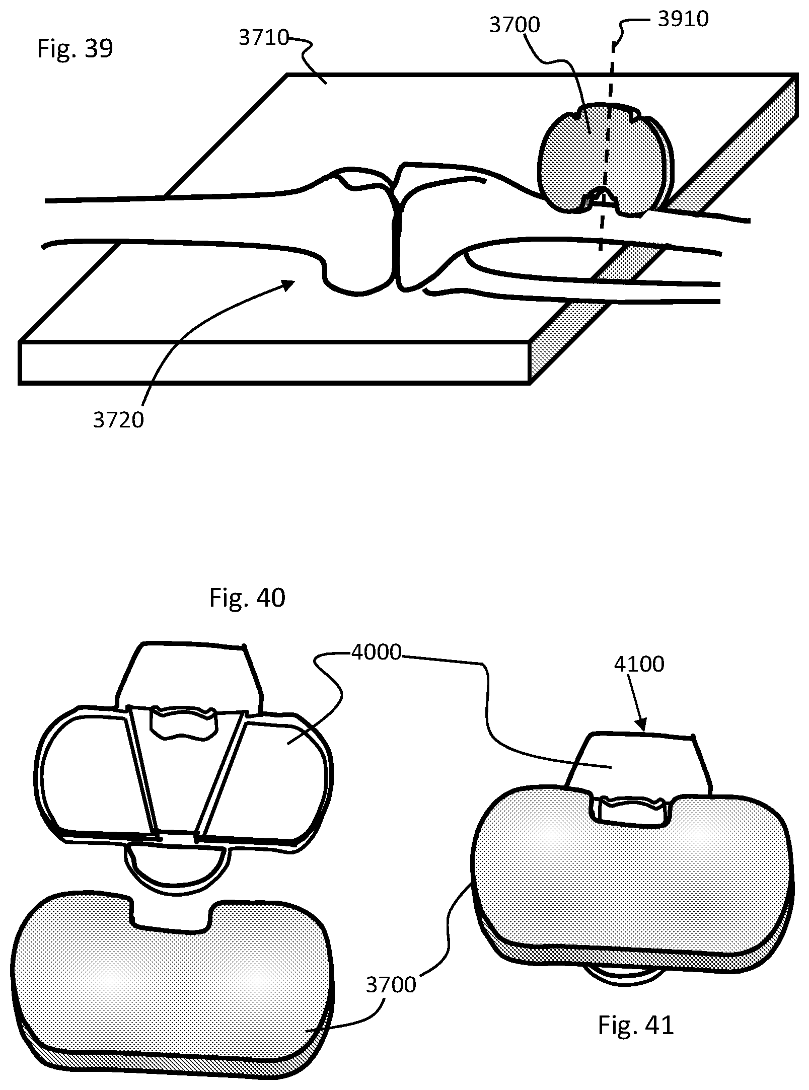 Patent US11793424 Figure 20 – Kinetic assessment and alignment of the muscular-skeletal system and method therefor