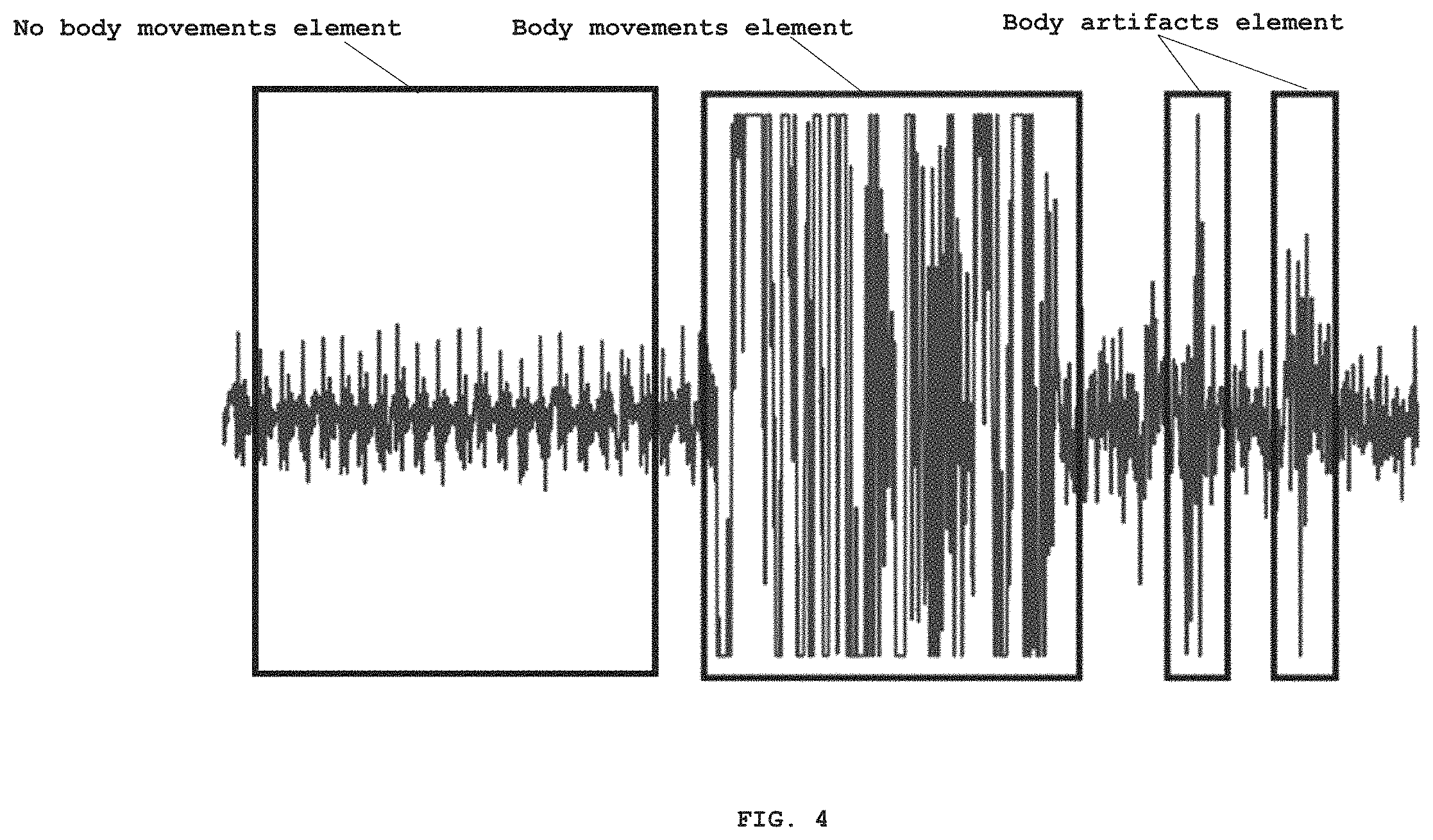 Patent US11793426 Figure 4 – System and a method for determining breathing rate as a biofeedback