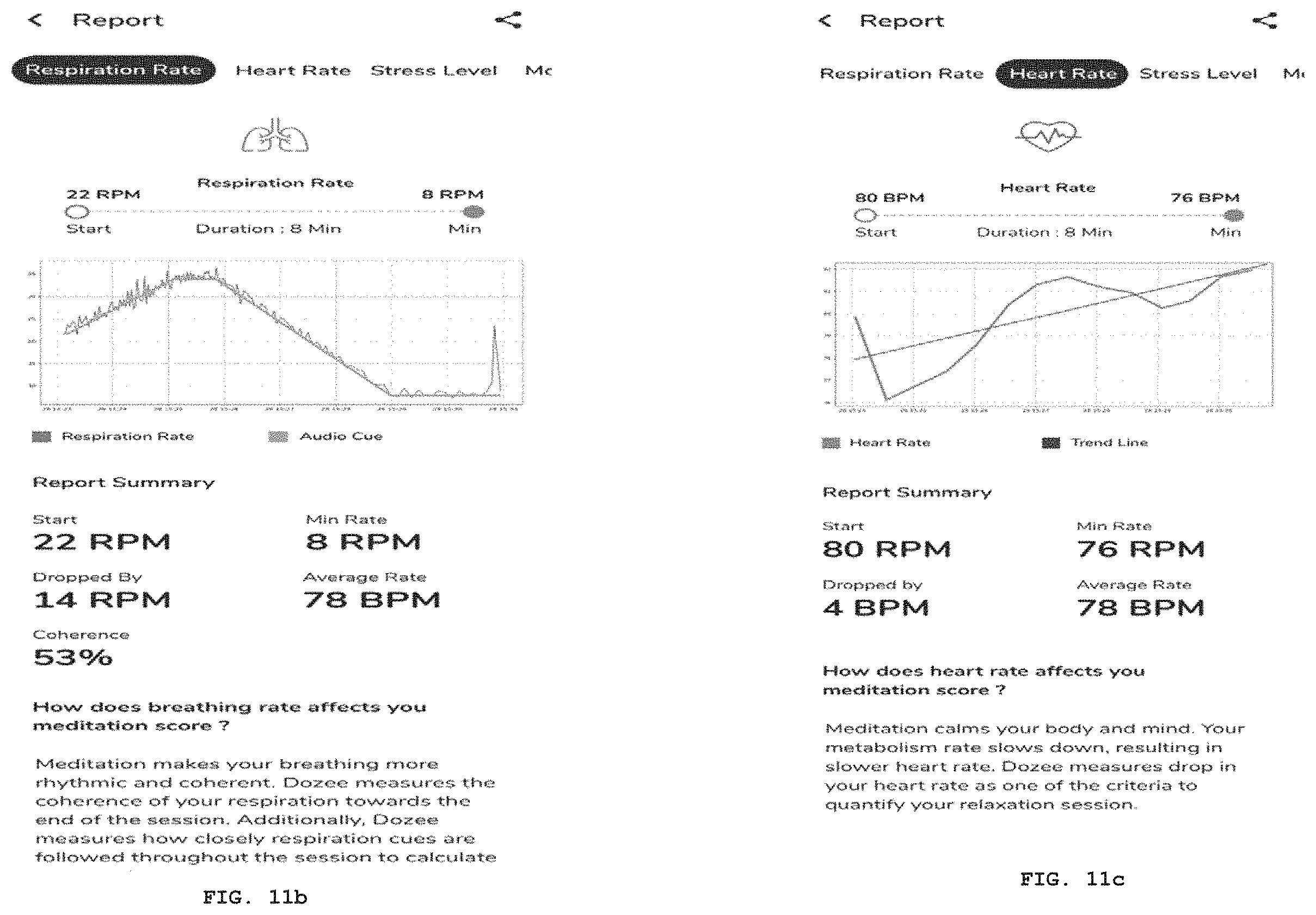 Patent US11793426 Figure 14 – System and a method for determining breathing rate as a biofeedback