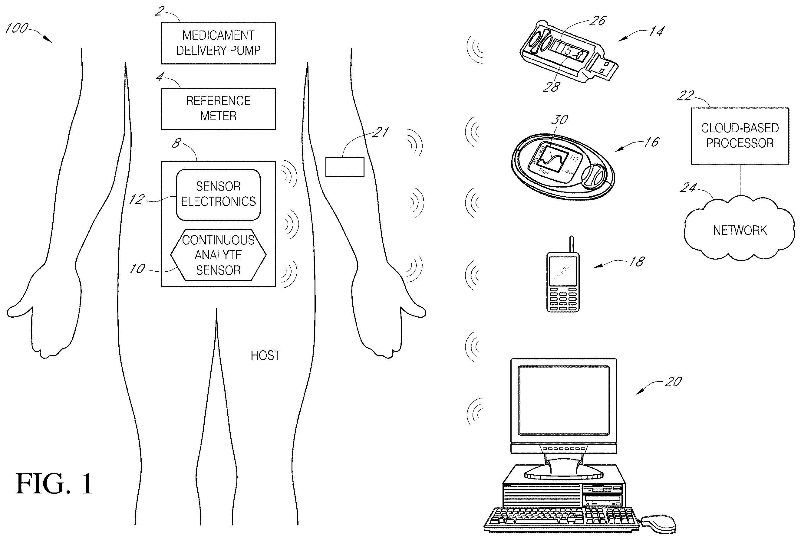Patent US11793428 Figure 1 – Indicator and analytics for sensor insertion in a continuous analyte monitoring system and related methods