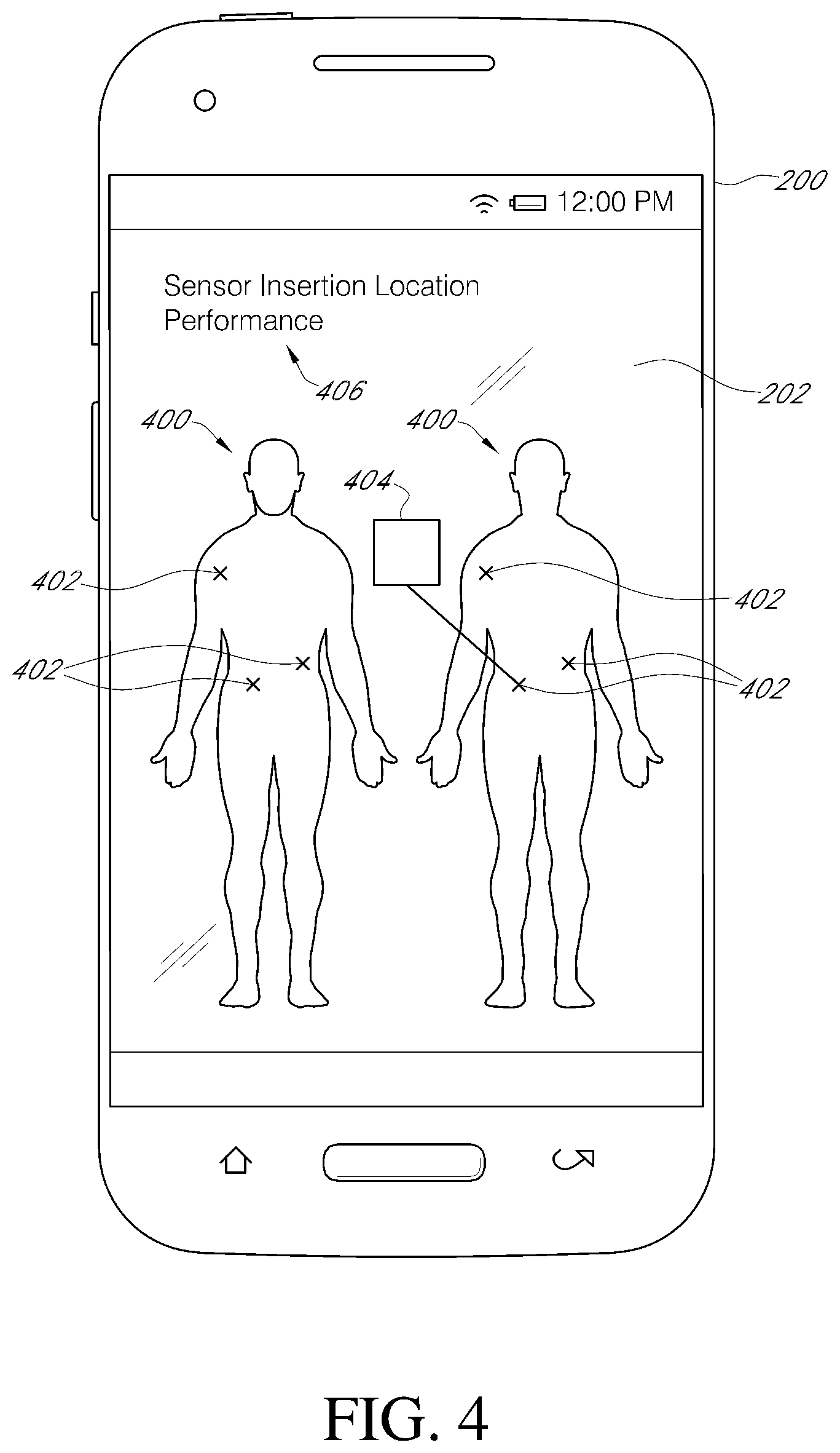 Patent US11793428 Figure 5 – Indicator and analytics for sensor insertion in a continuous analyte monitoring system and related methods