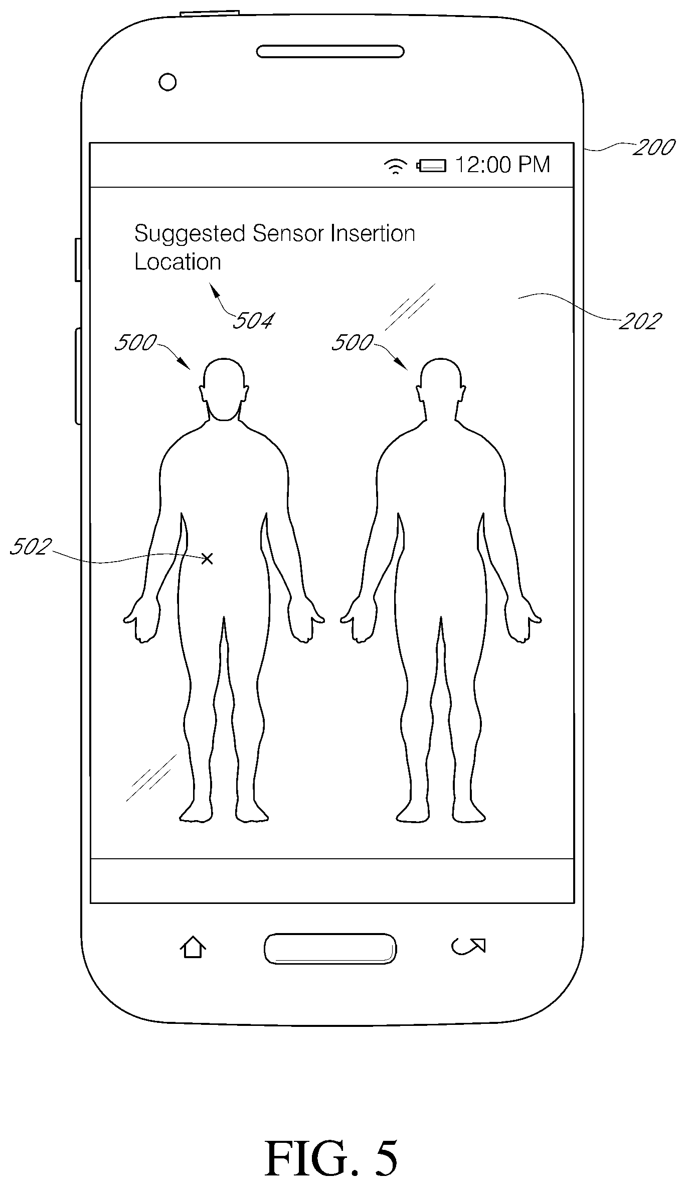 Patent US11793428 Figure 6 – Indicator and analytics for sensor insertion in a continuous analyte monitoring system and related methods