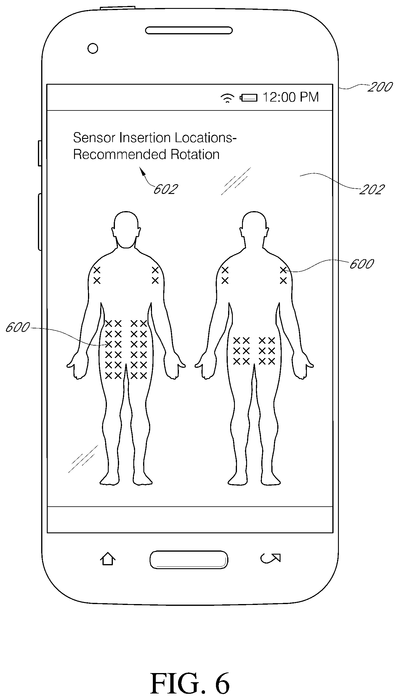 Patent US11793428 Figure 7 – Indicator and analytics for sensor insertion in a continuous analyte monitoring system and related methods