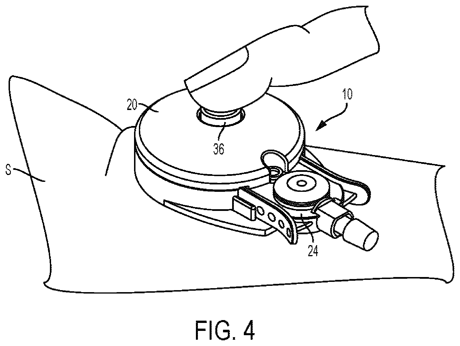 Patent US11793432 Figure 4 – Biological fluid collection device and biological fluid collection system