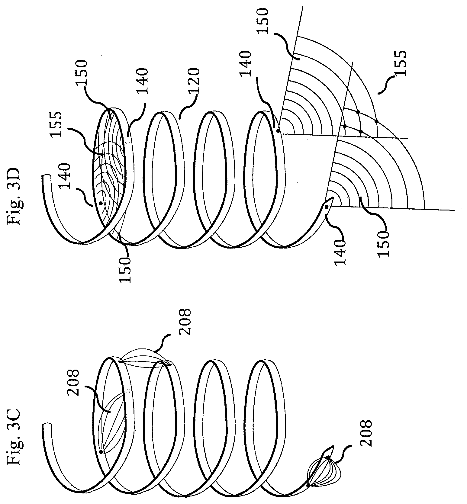 Patent US11793437 Figure 11 – Neural interface device and insertion tools