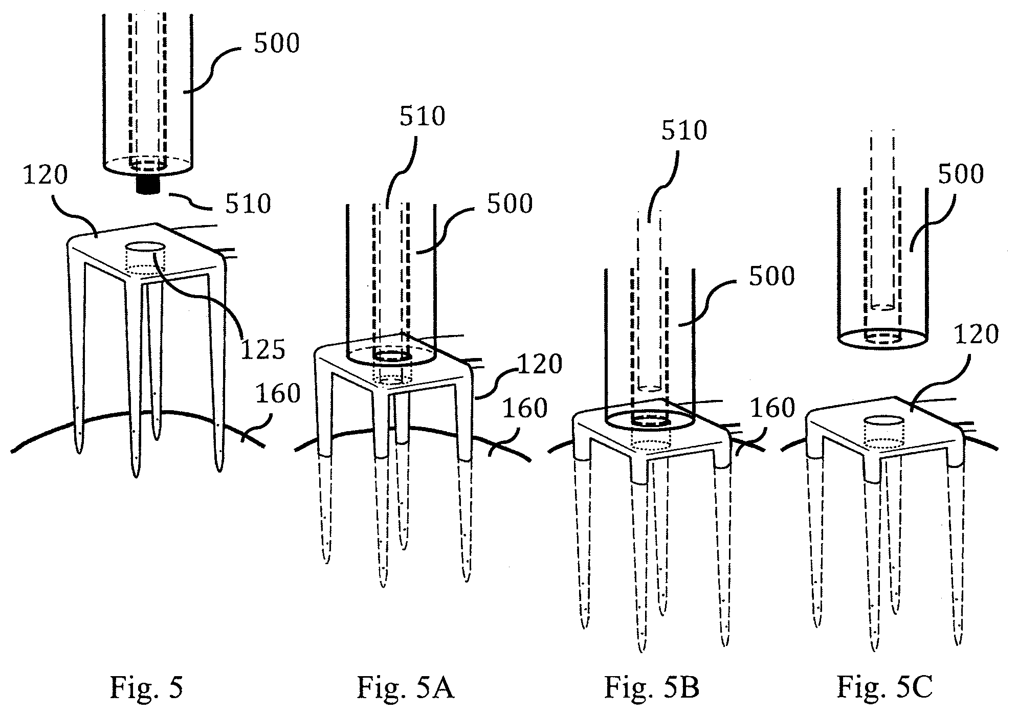 Patent US11793437 Figure 19 – Neural interface device and insertion tools