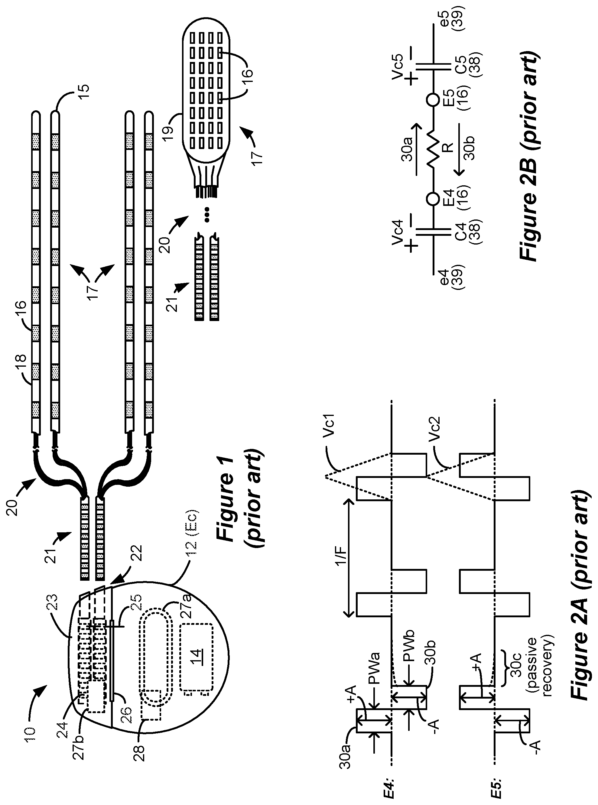 Patent US11793438 Figure 1 – Neural sensing in an implantable stimulator device during the provision of active stimulation