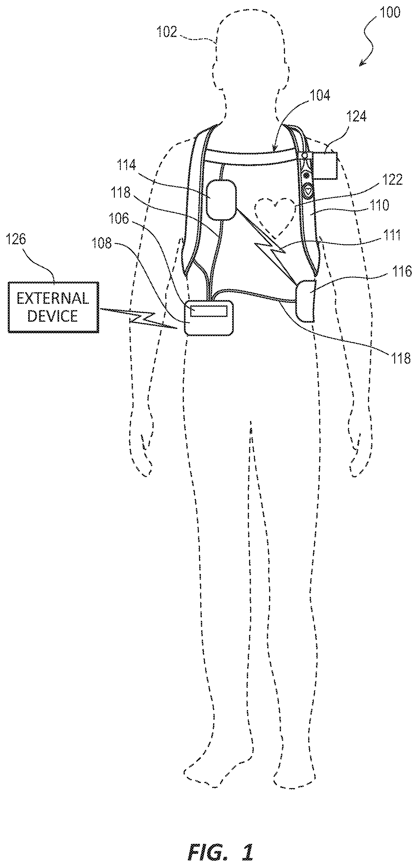 Patent US11793440 Figure 1 – Method to detect noise in a wearable cardioverter defibrillator