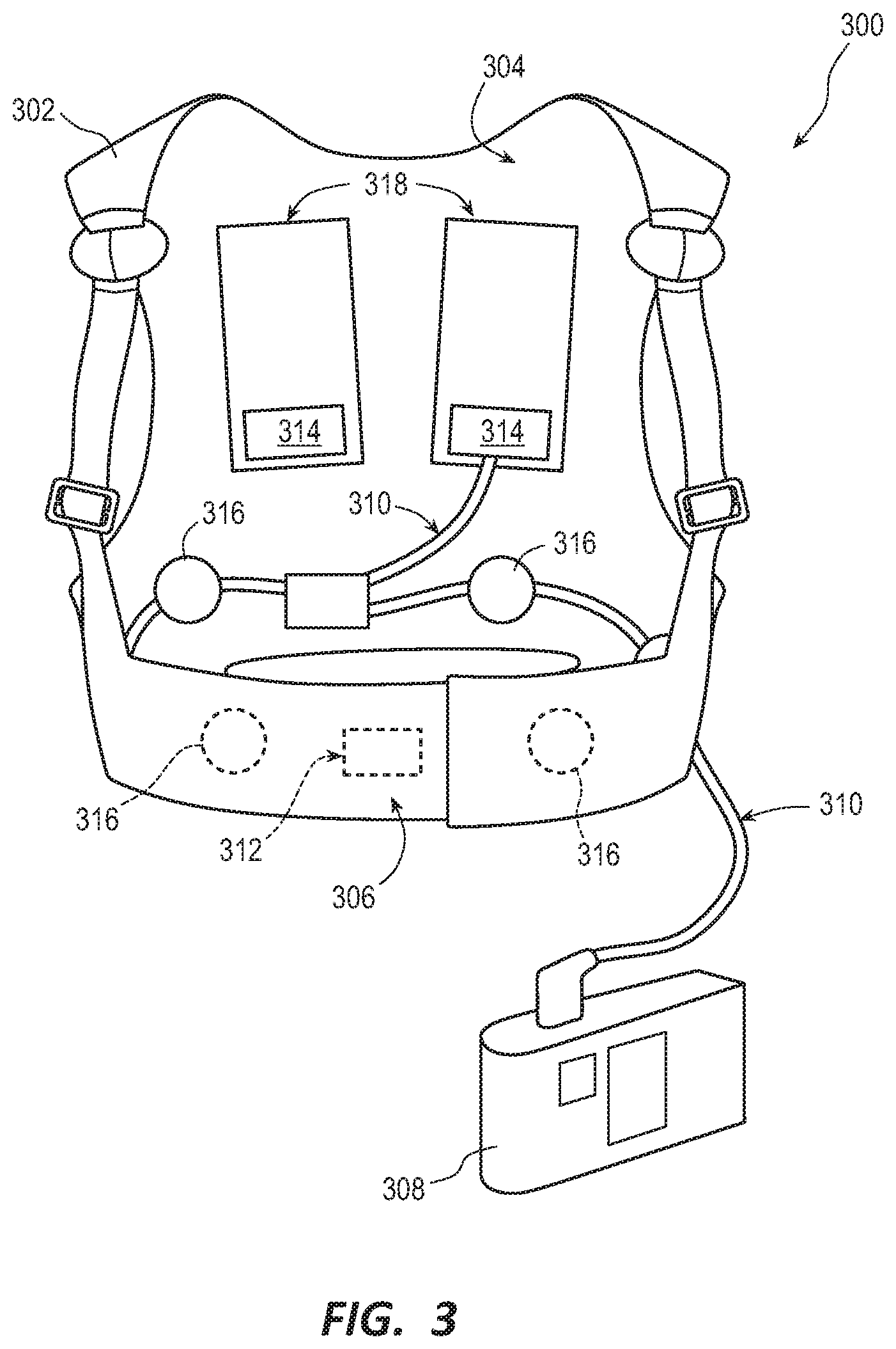 Patent US11793440 Figure 3 – Method to detect noise in a wearable cardioverter defibrillator