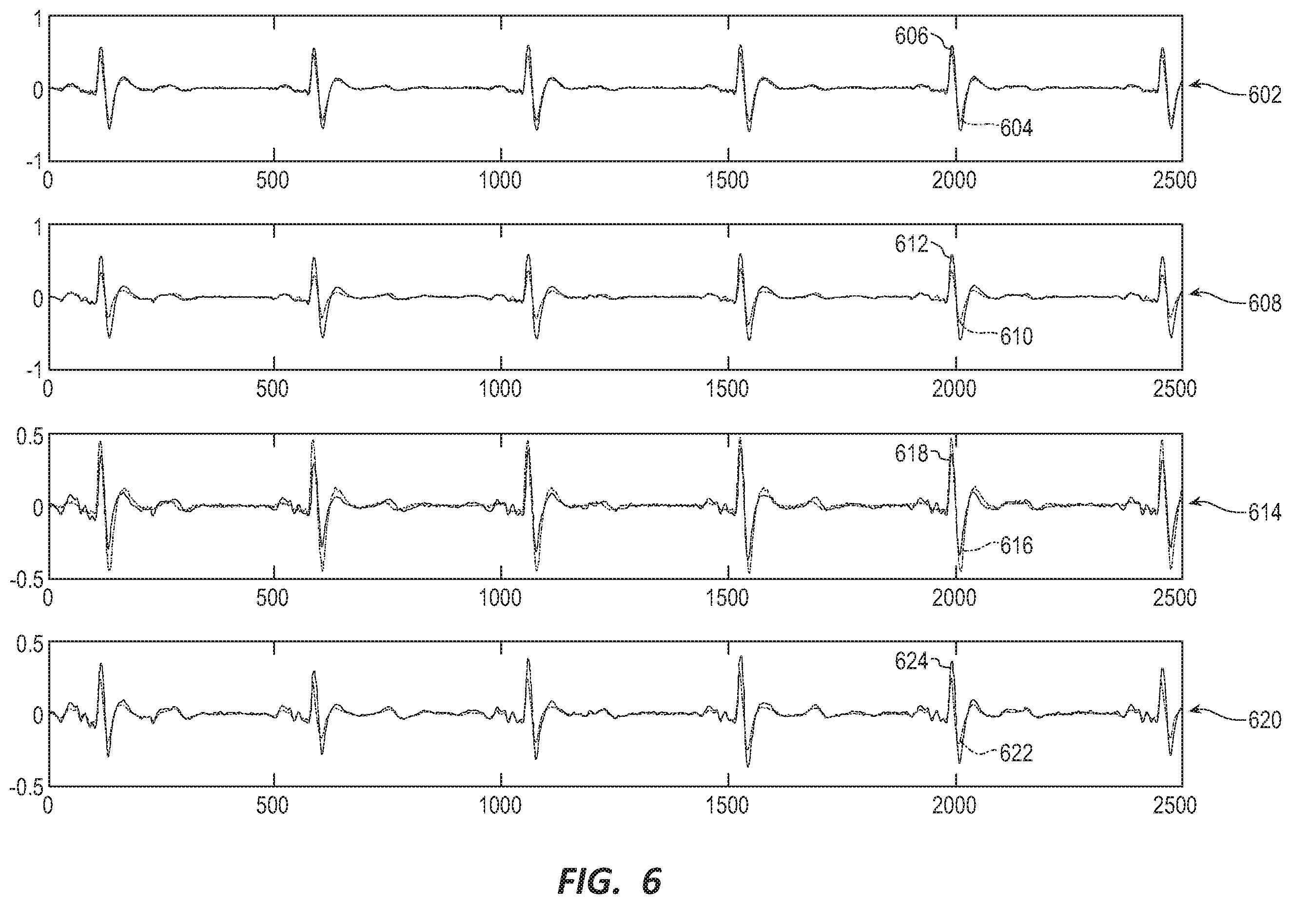 Patent US11793440 Figure 6 – Method to detect noise in a wearable cardioverter defibrillator