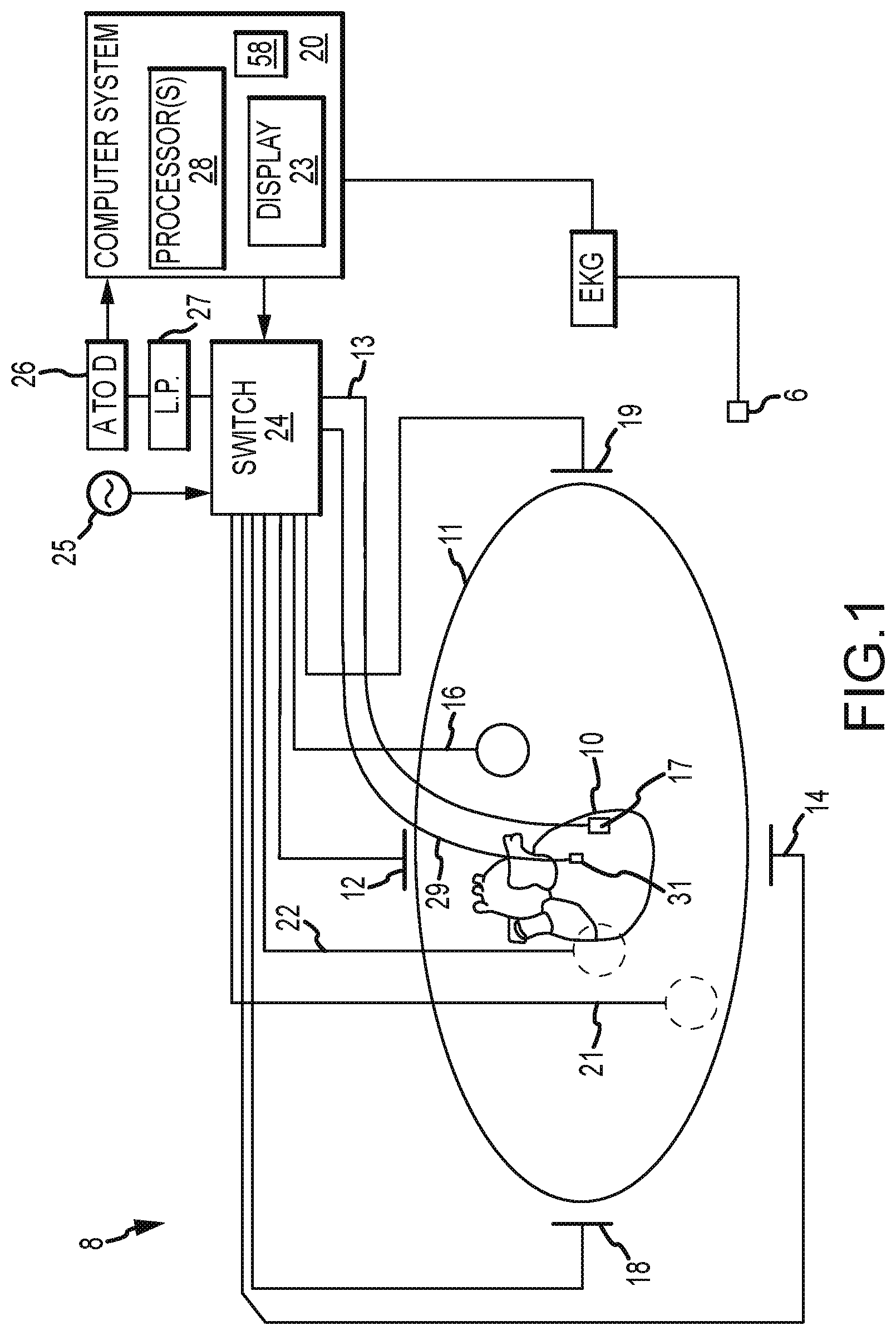 Patent US11793442 Figure 1 – System and method for mapping arrhythmic driver sites
