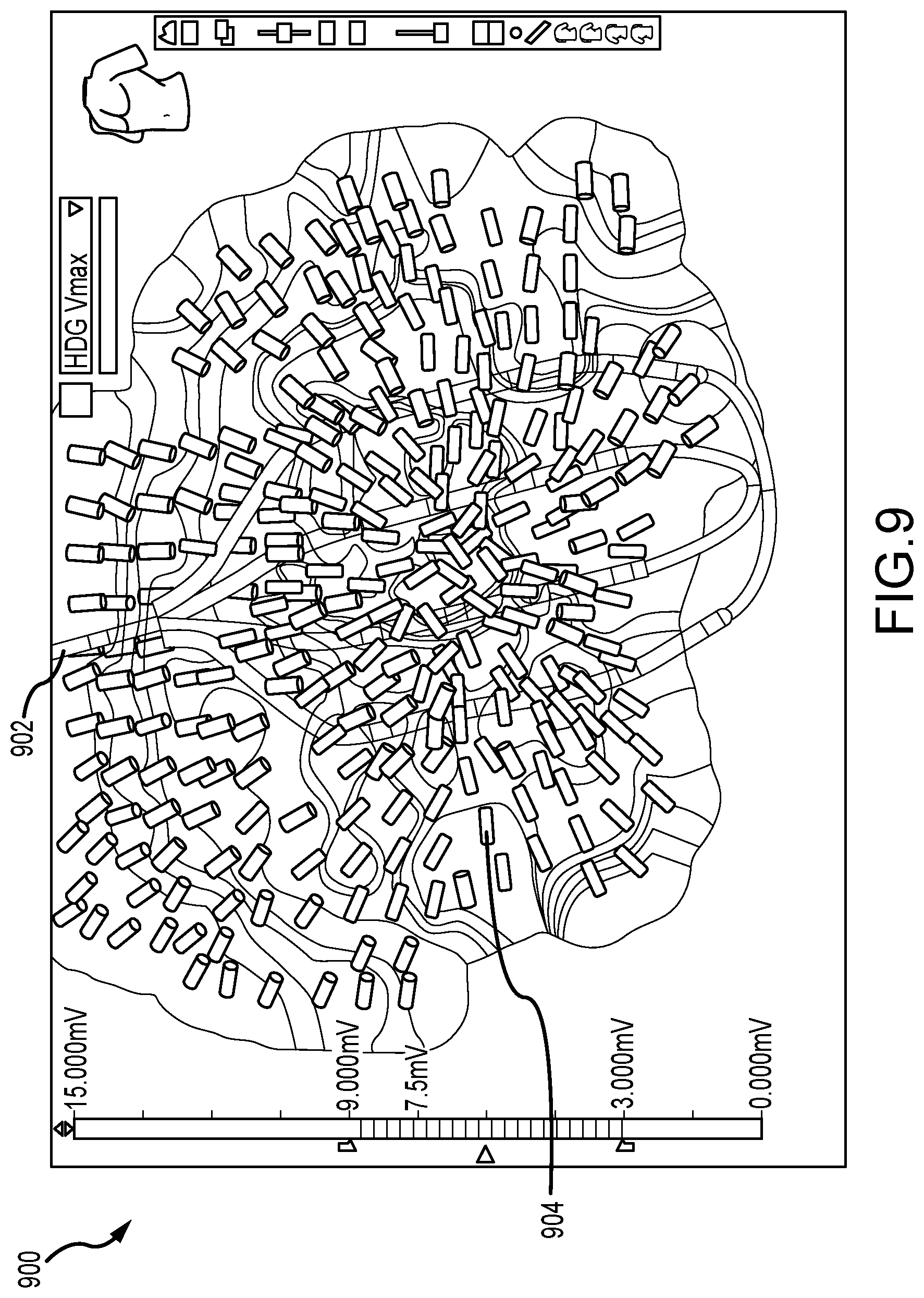 Patent US11793442 Figure 11 – System and method for mapping arrhythmic driver sites