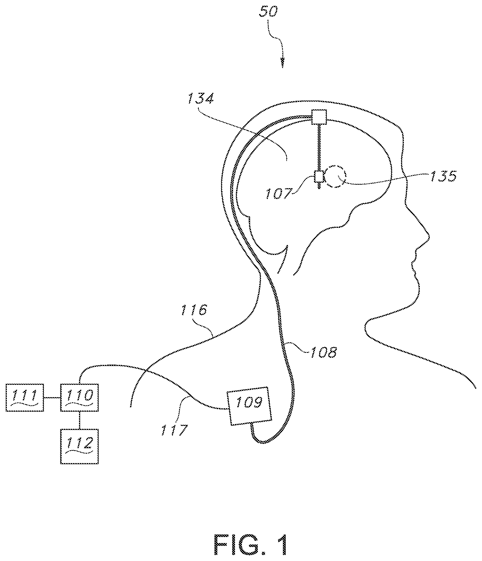 Patent US11793443 Figure 1 – Adjustable random electrical stimulation technologies