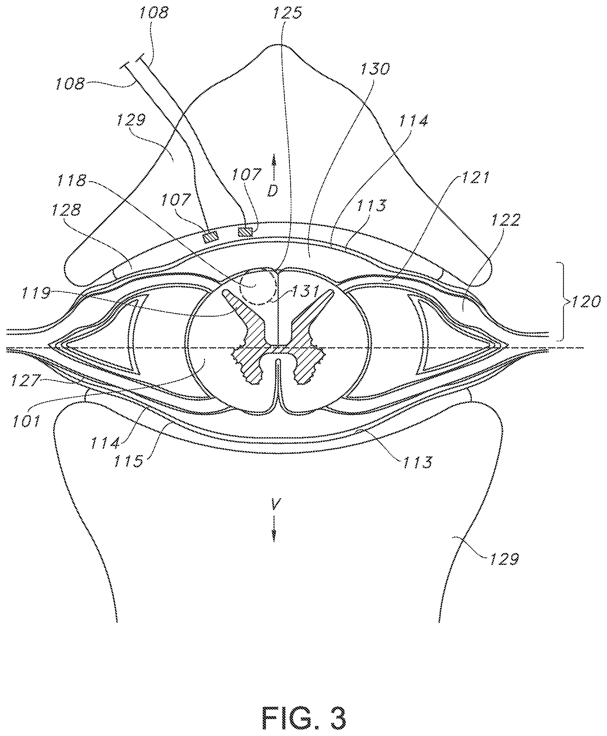 Patent US11793443 Figure 3 – Adjustable random electrical stimulation technologies