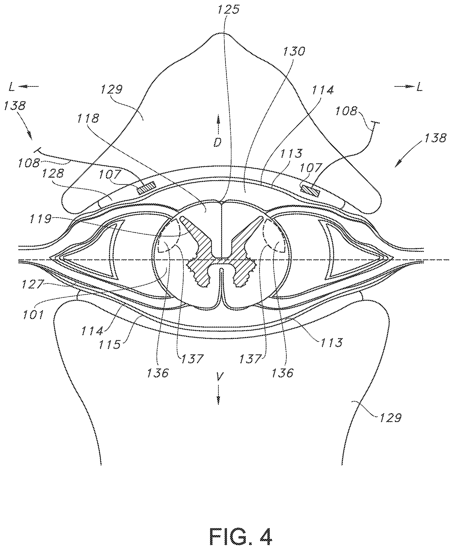 Patent US11793443 Figure 4 – Adjustable random electrical stimulation technologies