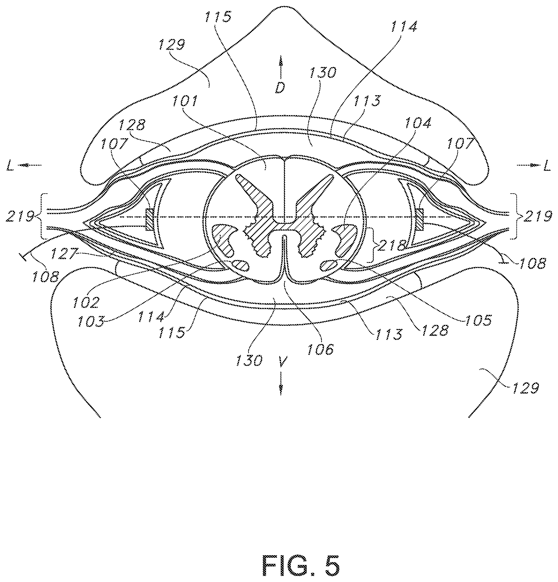 Patent US11793443 Figure 5 – Adjustable random electrical stimulation technologies