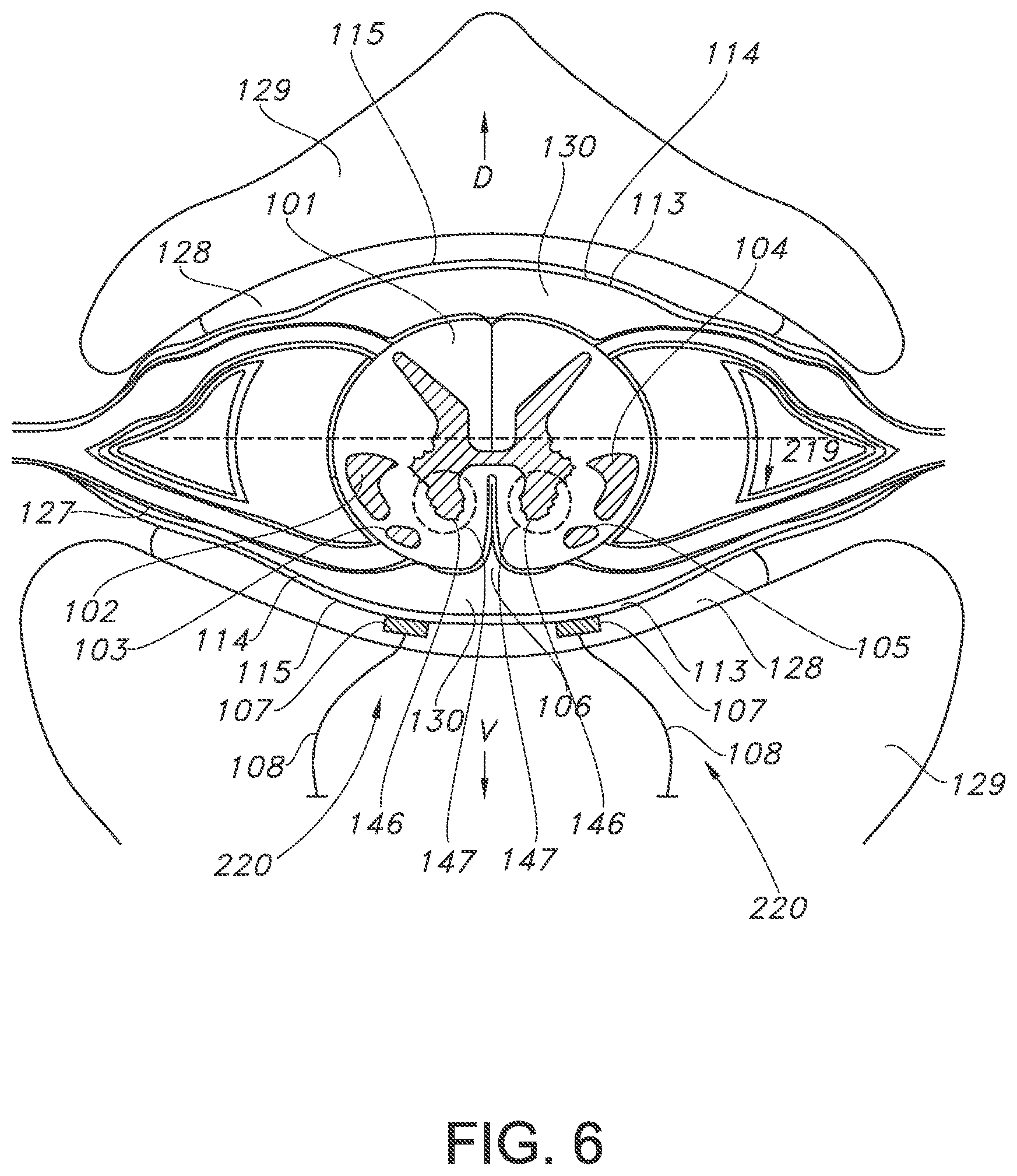 Patent US11793443 Figure 6 – Adjustable random electrical stimulation technologies